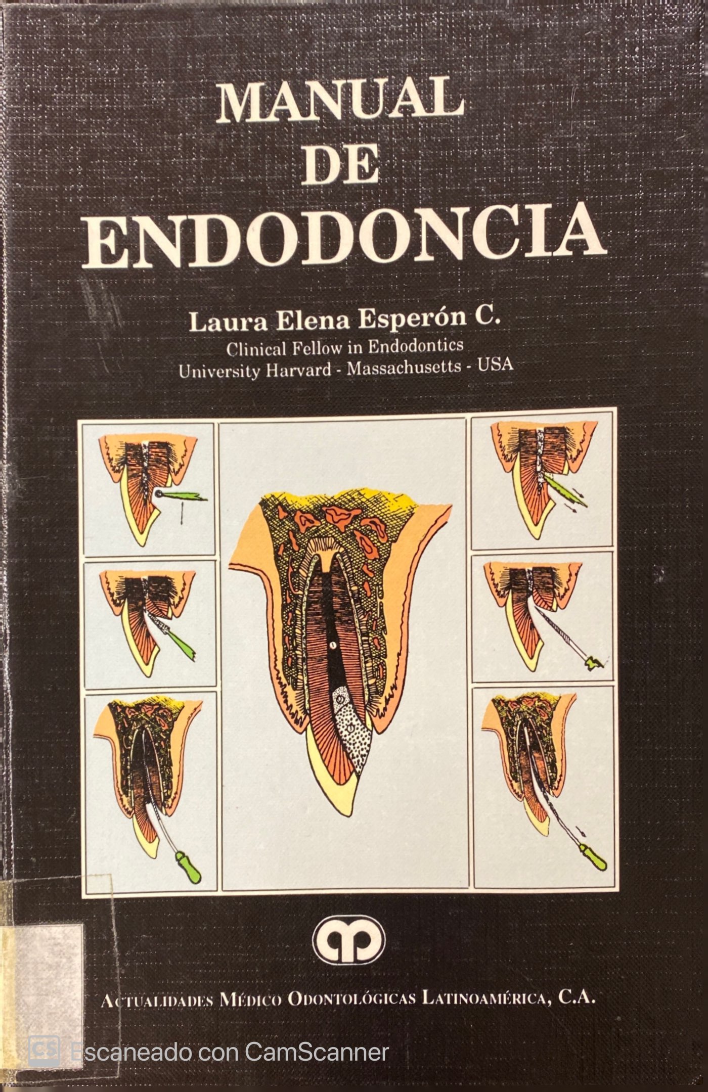 MANUAL DE ENDODONCIA