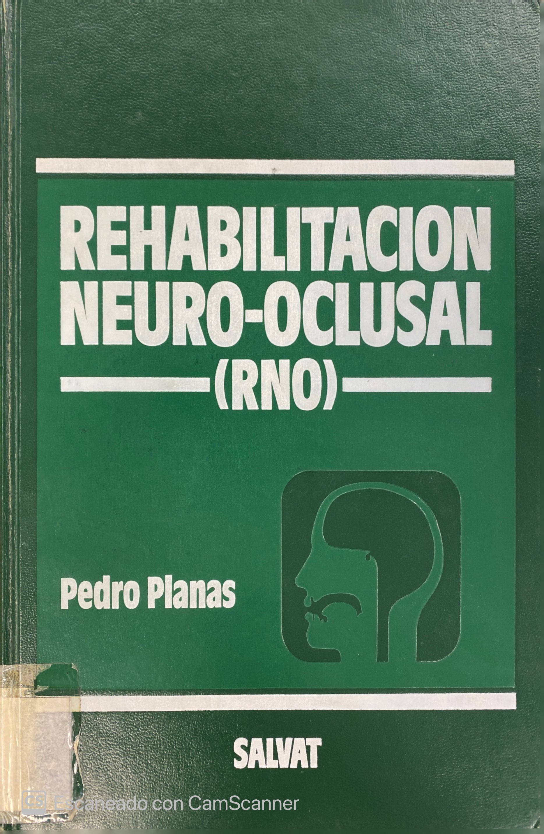 REHABILITACIÓN NEURO-OCLUSAL (RNO)