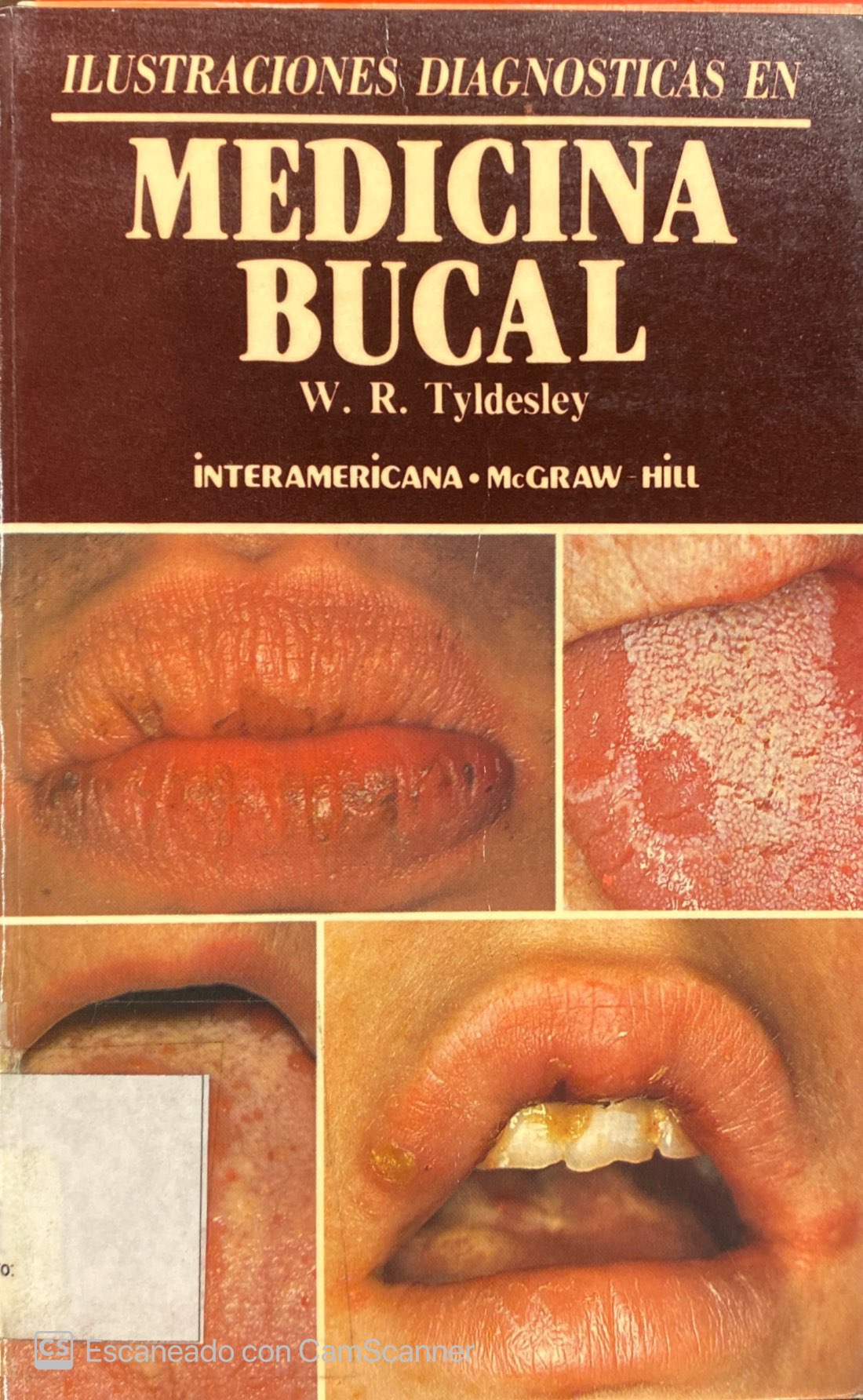 ILUSTRACIONES DIAGNÓSTICAS EN MEDICINA BUCAL