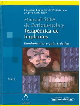 MANUAL SEPA DE PERIODONCIA Y TERAPÉUTICA DE IMPLANTES: FUNDAMENTOS Y GUÍA PRÁCTICA TOMO 1
