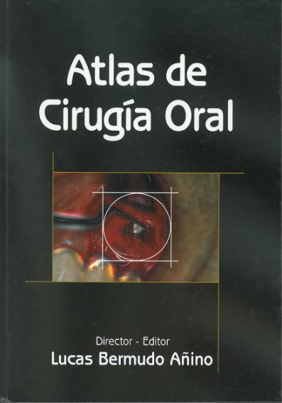 ATLAS DE CIRUGÍA ORAL