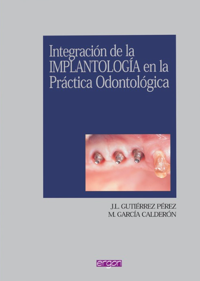 INTEGRACIÓN DE LA IMPLANTOLOGÍA EN LA PRÁCTICA ODONTOLÓGICA