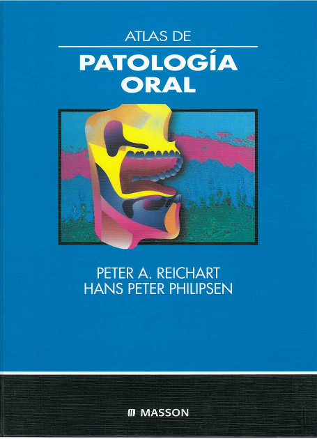 ATLAS DE PATOLOGÍA ORAL