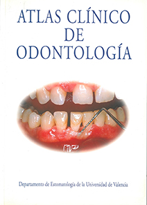 ATLAS CLÍNICO DE ODONTOLOGÍA