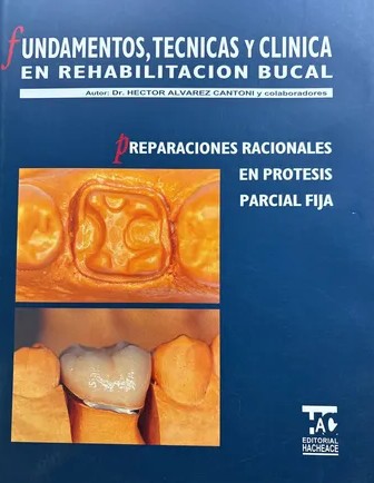 FUNDAMENTOS, TÉCNICAS Y CLÍNICA EN REHABILITACIÓN BUCAL. PREPARACIONES RACIONALES EN PRÓTESIS PARCIAL FIJA.