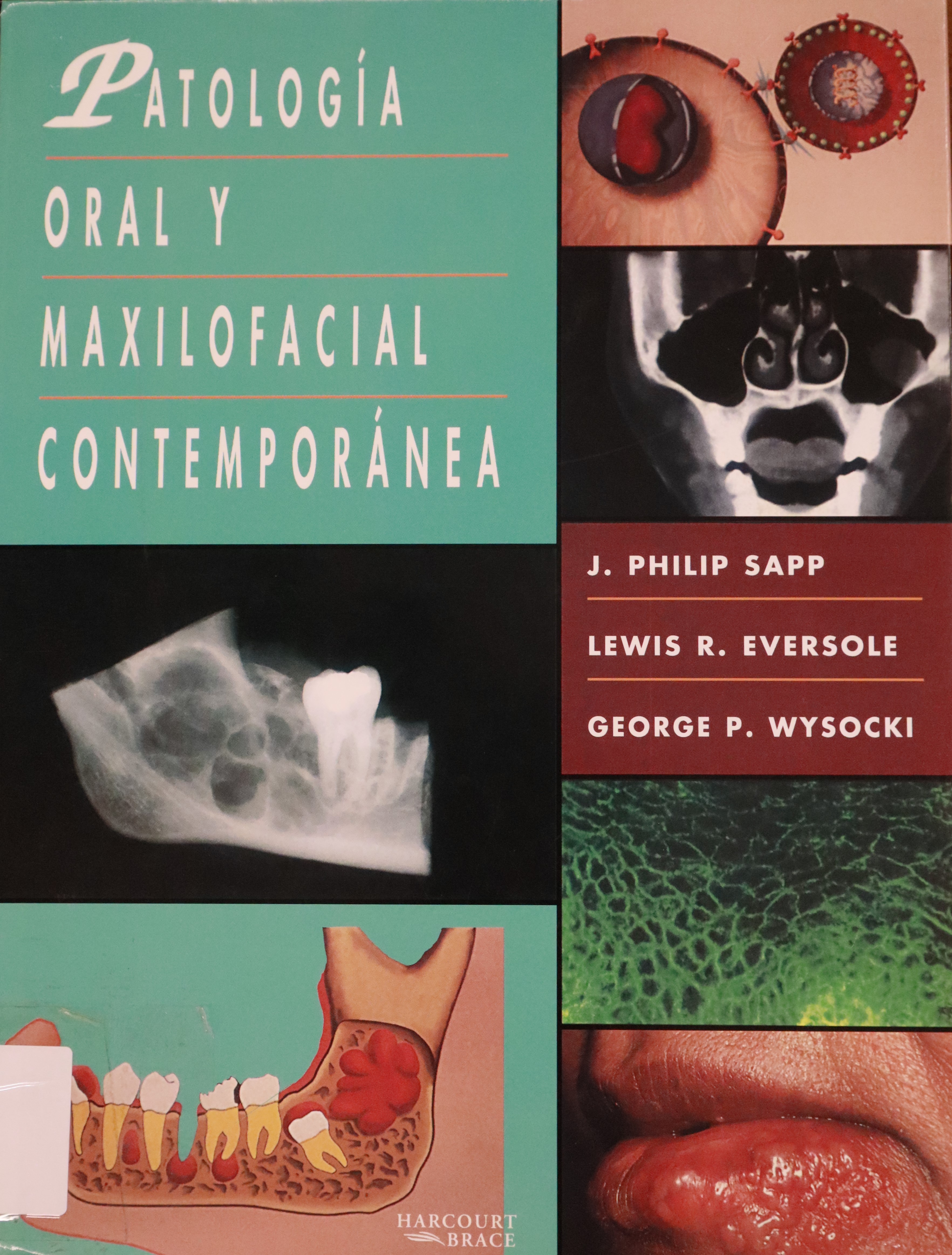 PATOLOGÍA ORAL Y MAXILOFACIAL CONTEMPORÁNEA