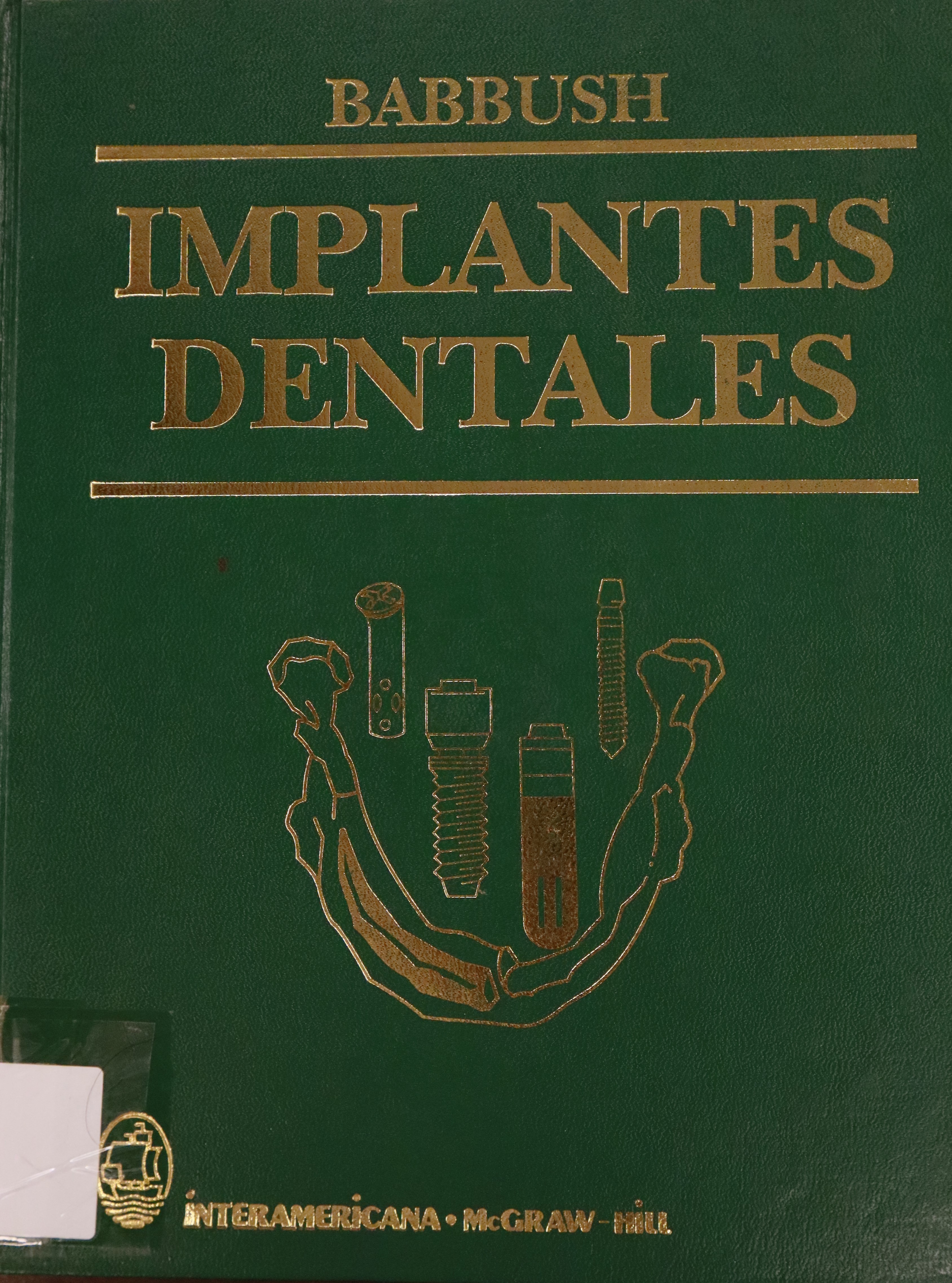 IMPLANTES DENTALES