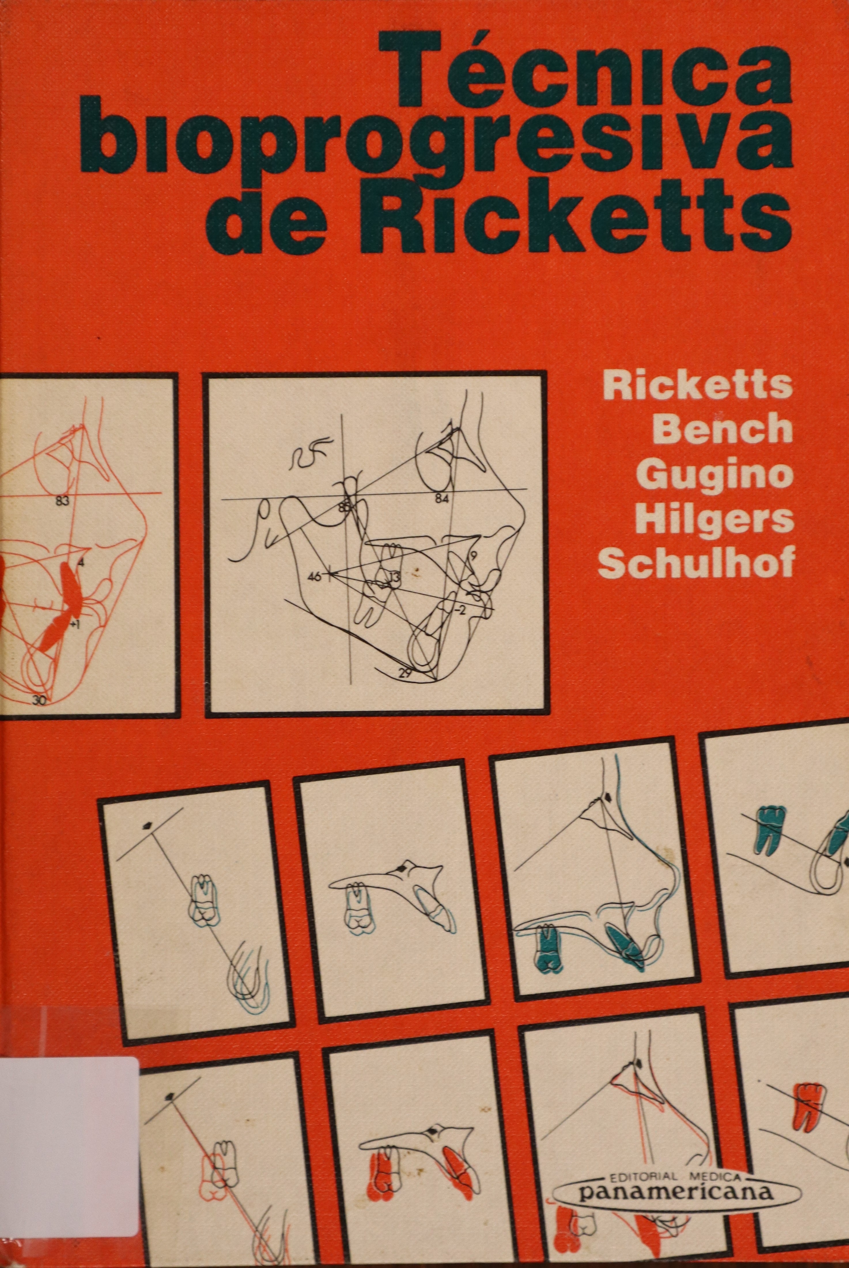 TÉCNICA BIOPROGRESIVA DE RICKETTS