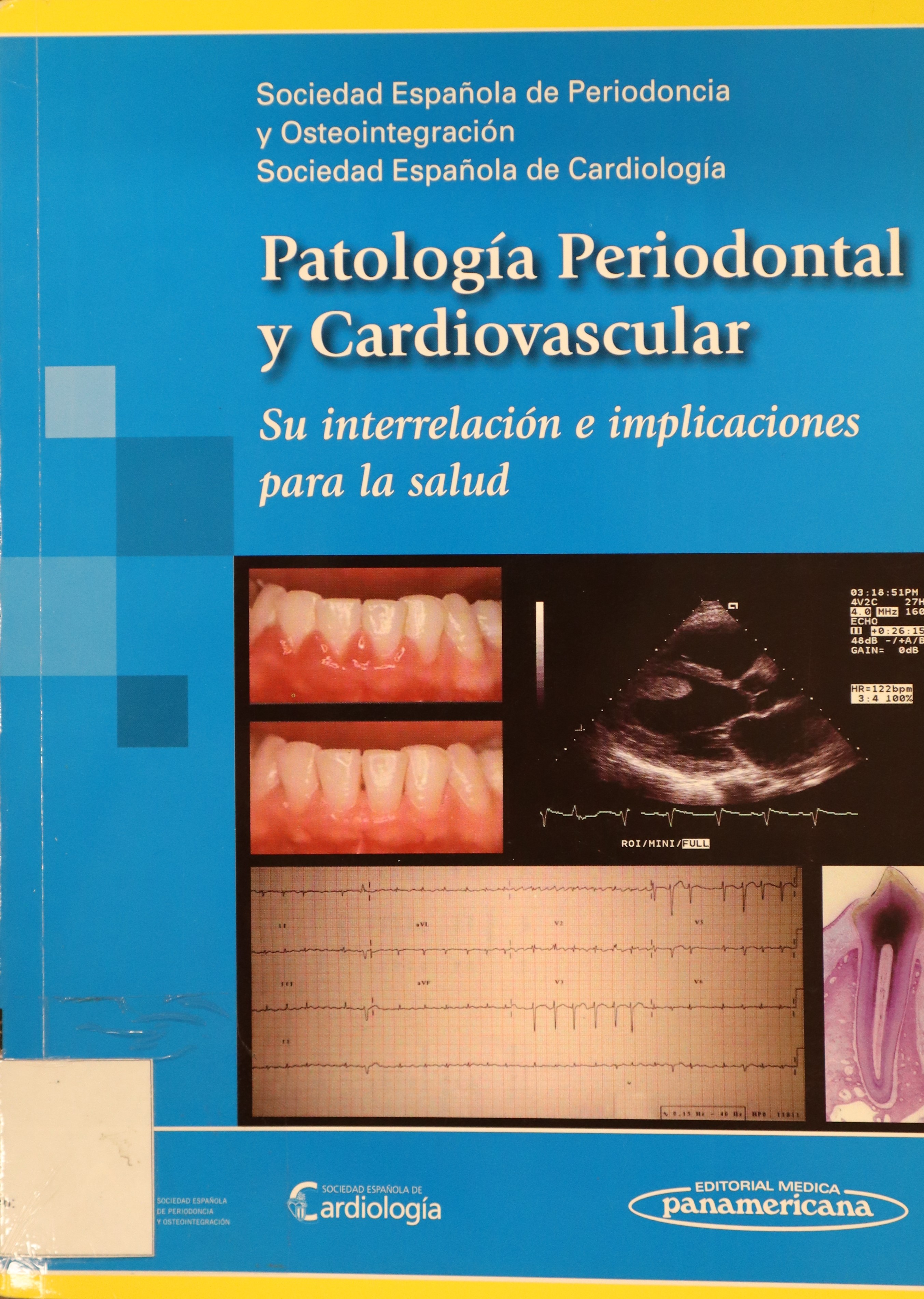 PATOLOGÍA PERIODONTAL Y CARDIOVASCULAR: SU INTERRELACIÓN E IMPLICACIONES PARA LA SALUD