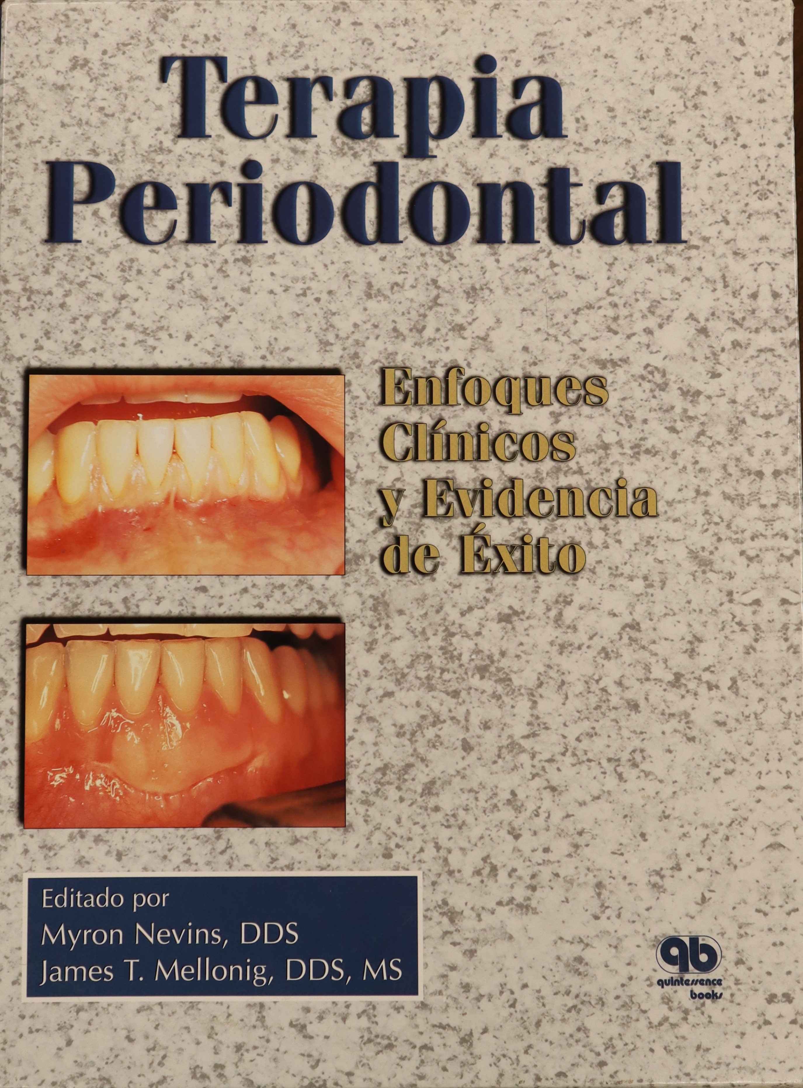 TERAPIA PERIODONTAL: ENFOQUES CLÍNICOS Y EVIDENCIA DE ÉXITO