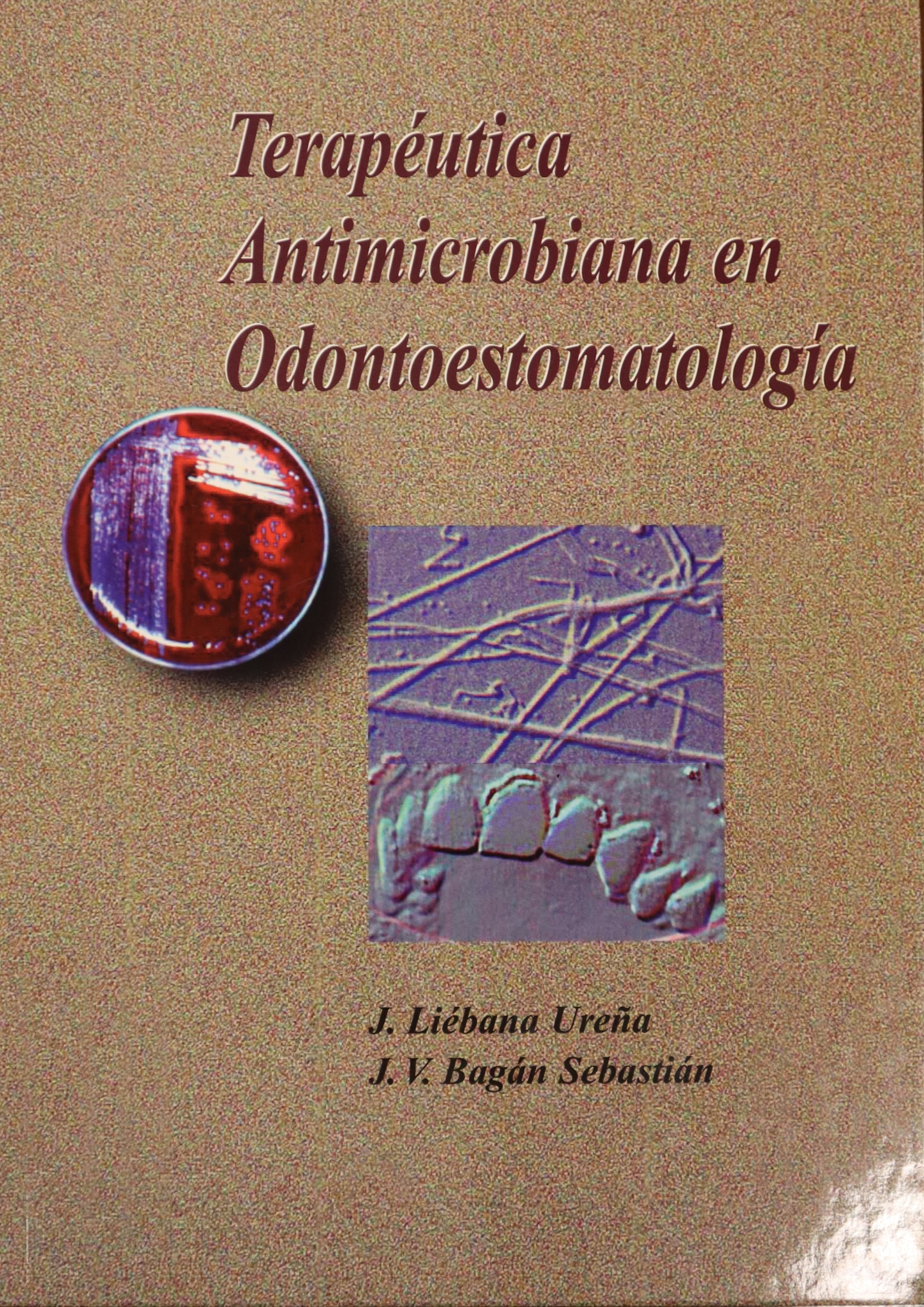 TERAPÉUTICA ANTIMICROBIANA EN ODONTOESTOMATOLOGÍA