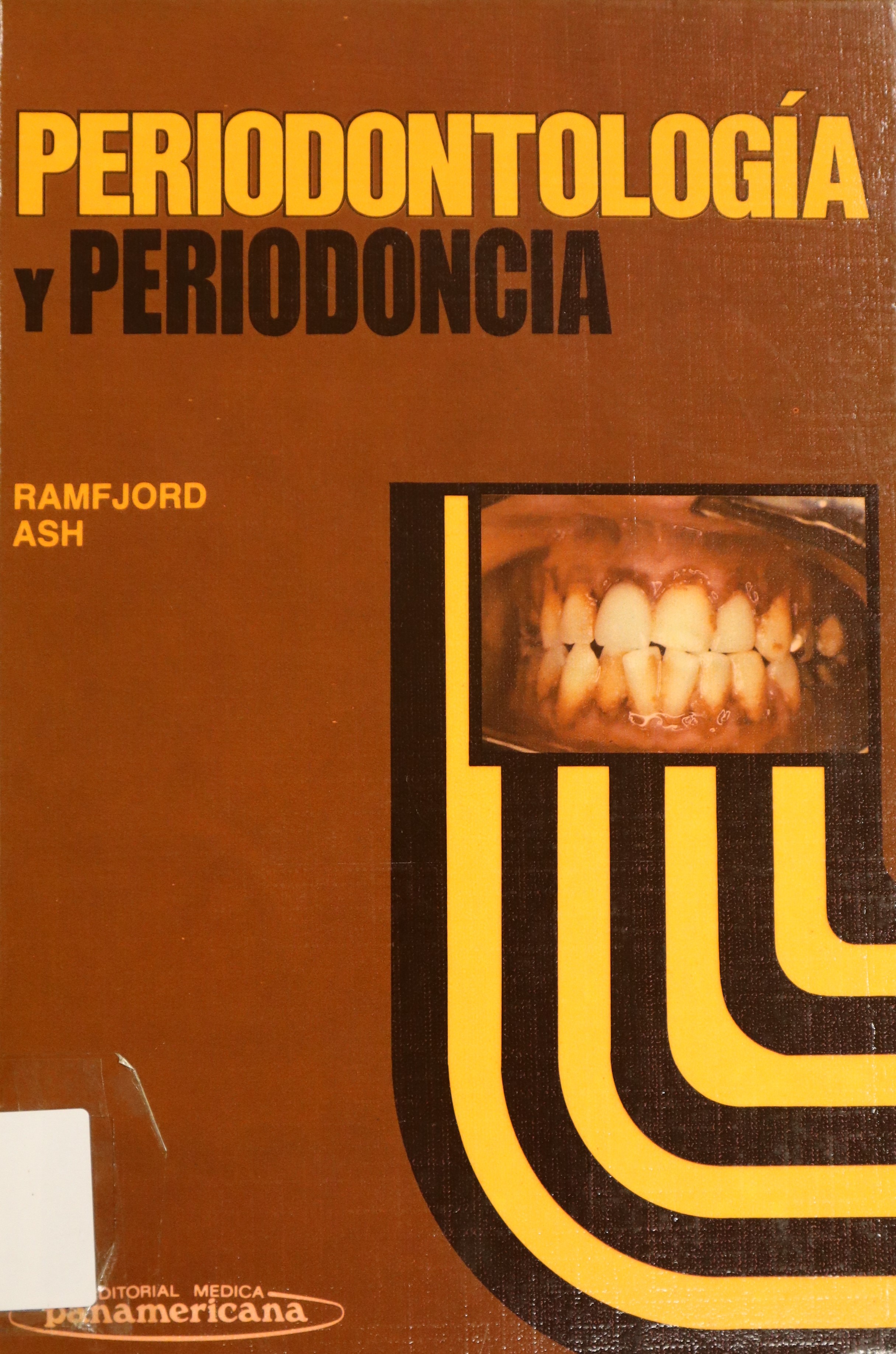 PERIODONTOLOGÍA Y PERIODONCIA