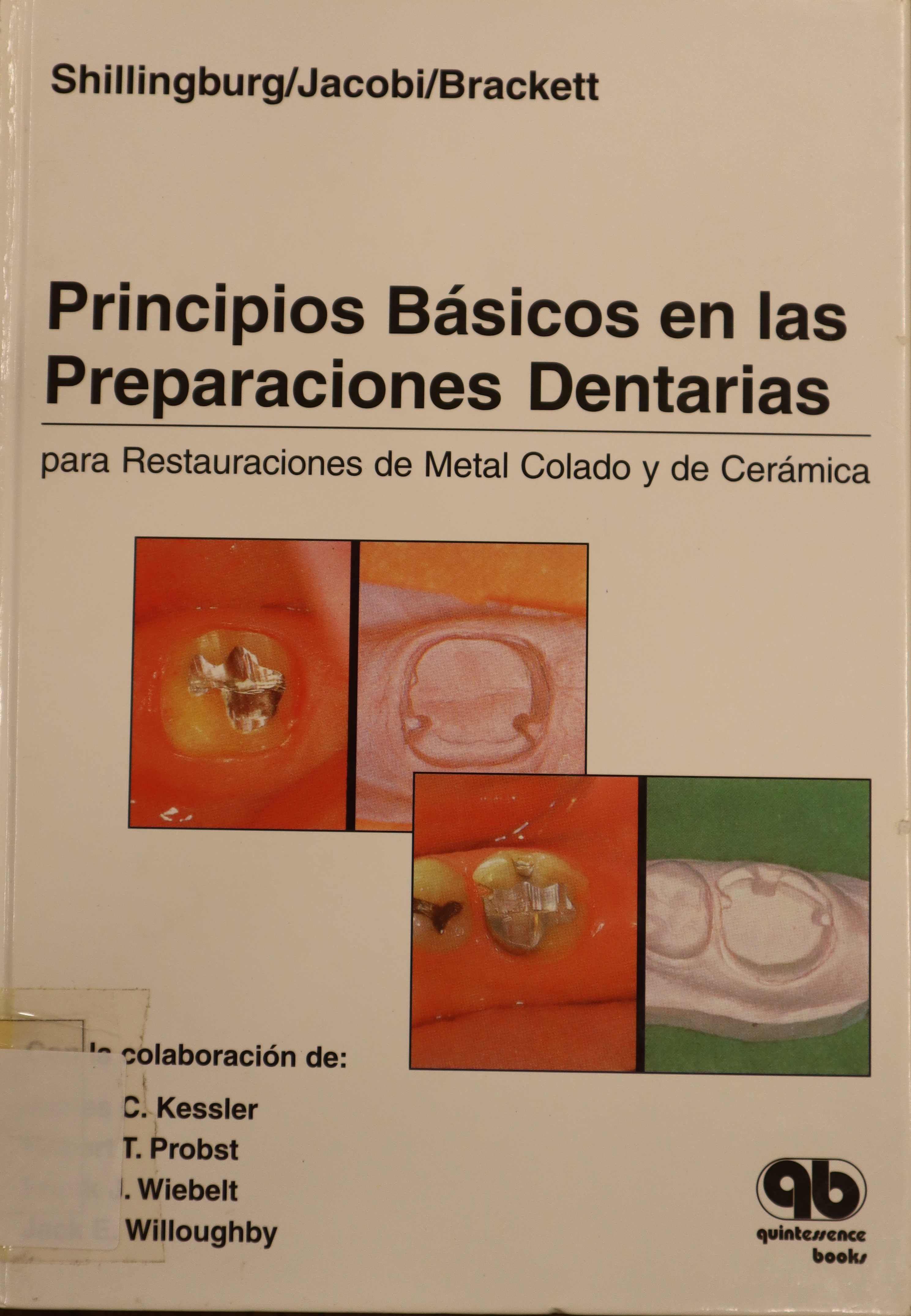 PRINCIPIOS BÁSICOS EN LAS PREPARACIONES DENTARIAS PARA RESTAURACIONES DE METAL COLADO Y DE CERÁMICA