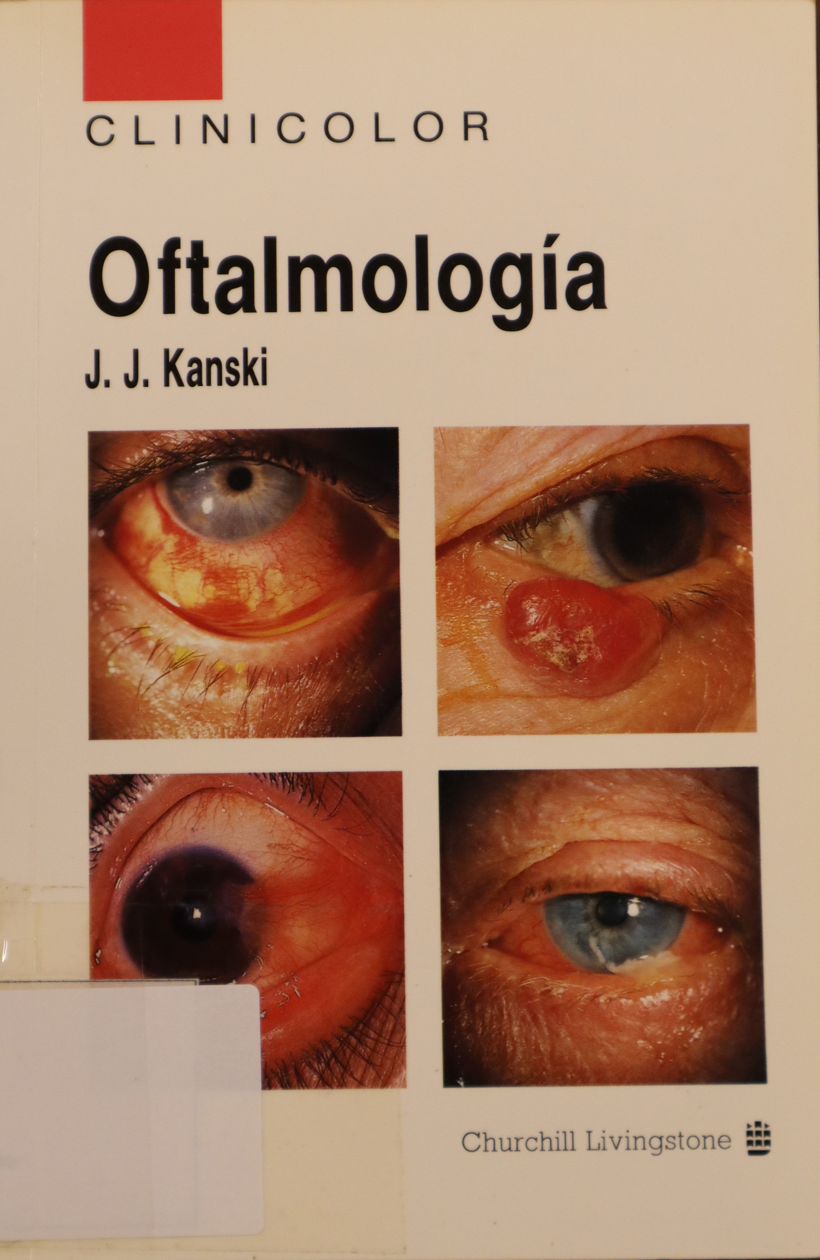 OFTALMOLOGÍA