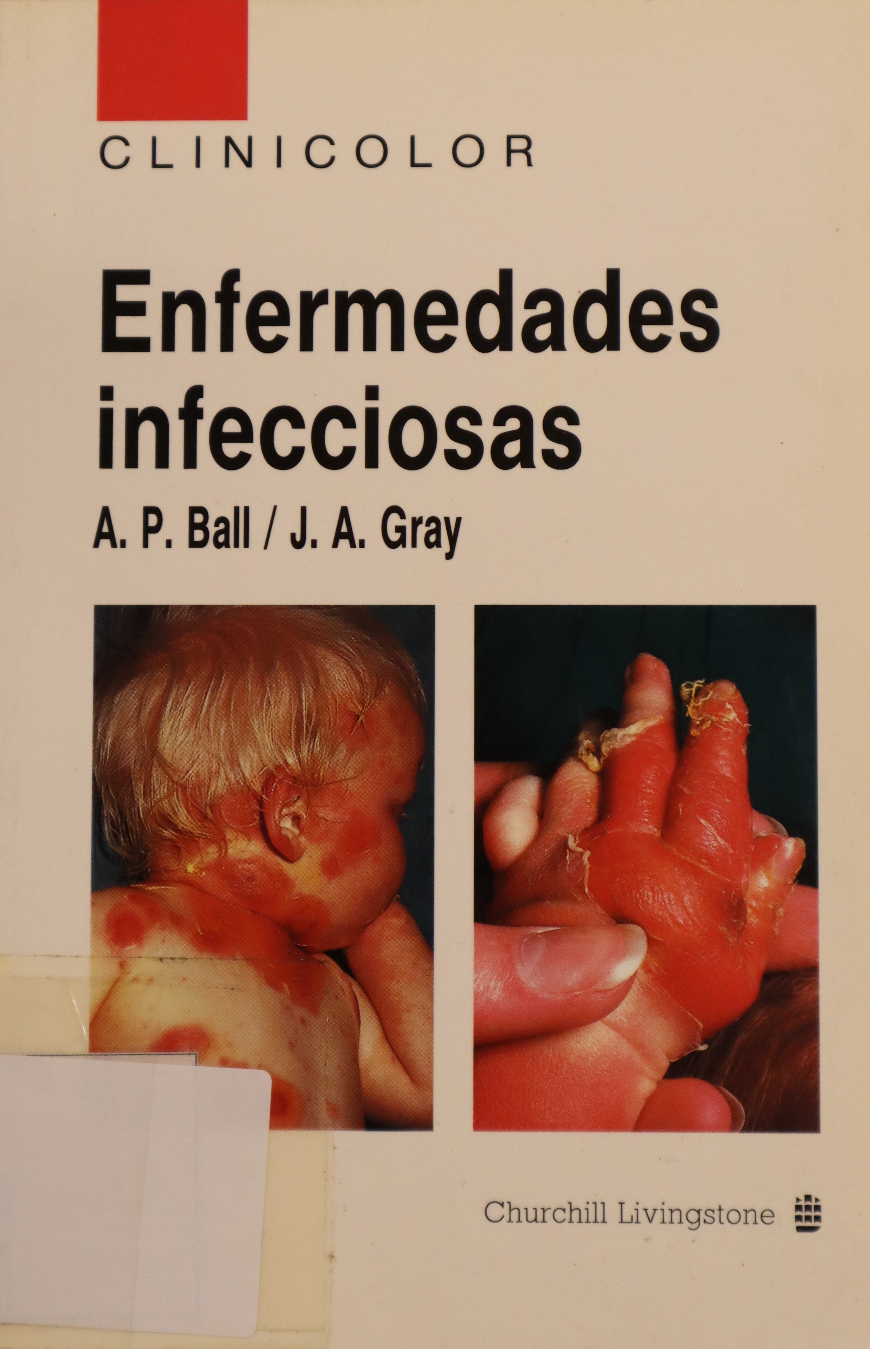 ENFERMEDADES INFECCIOSAS