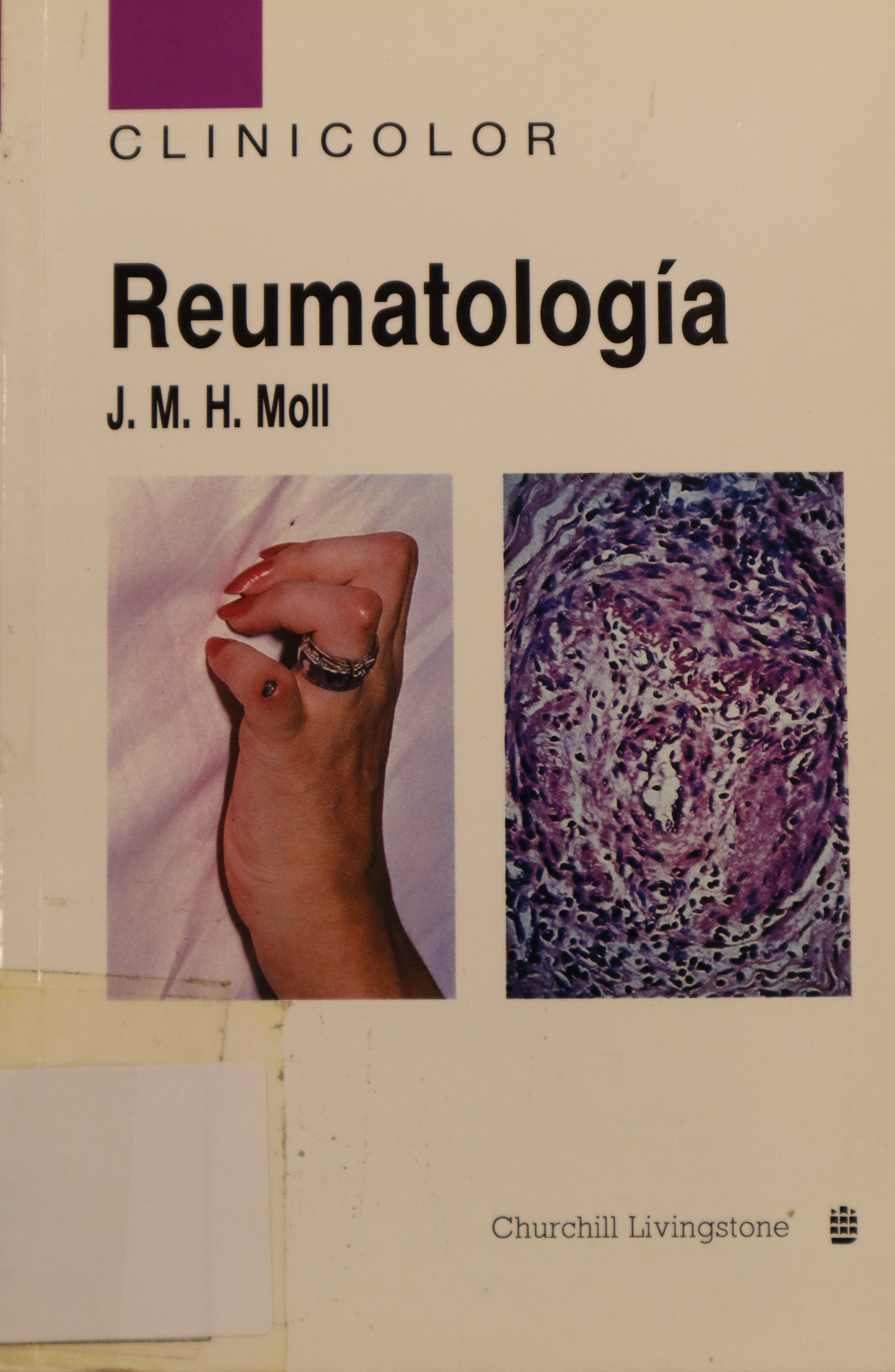 REUMATOLOGÍA