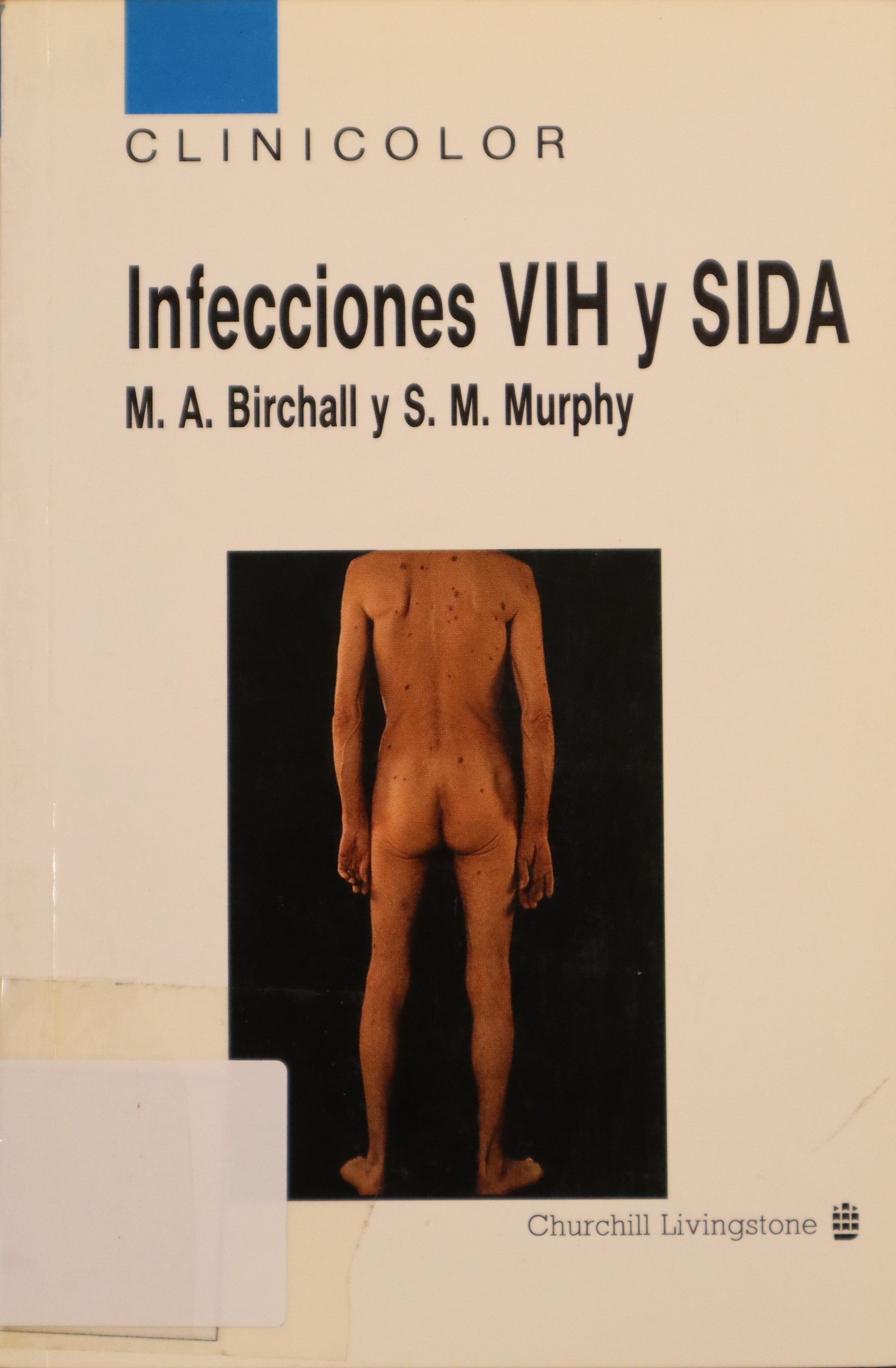 INFECCIONES VIH Y SIDA