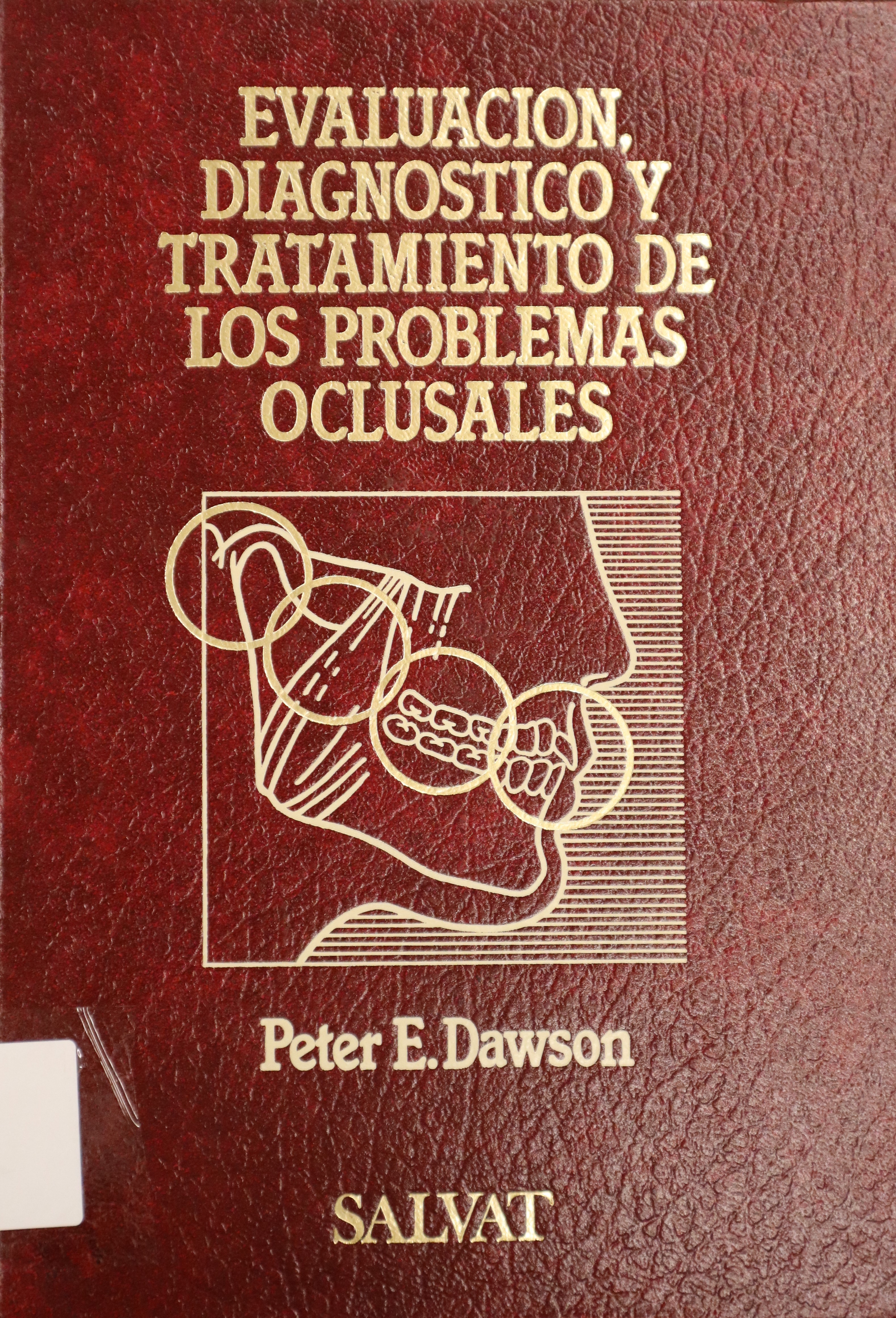 EVALUACIÓN, DIAGNÓSTICO Y TRATAMIENTO DE LOS PROBLEMAS OCLUSALES