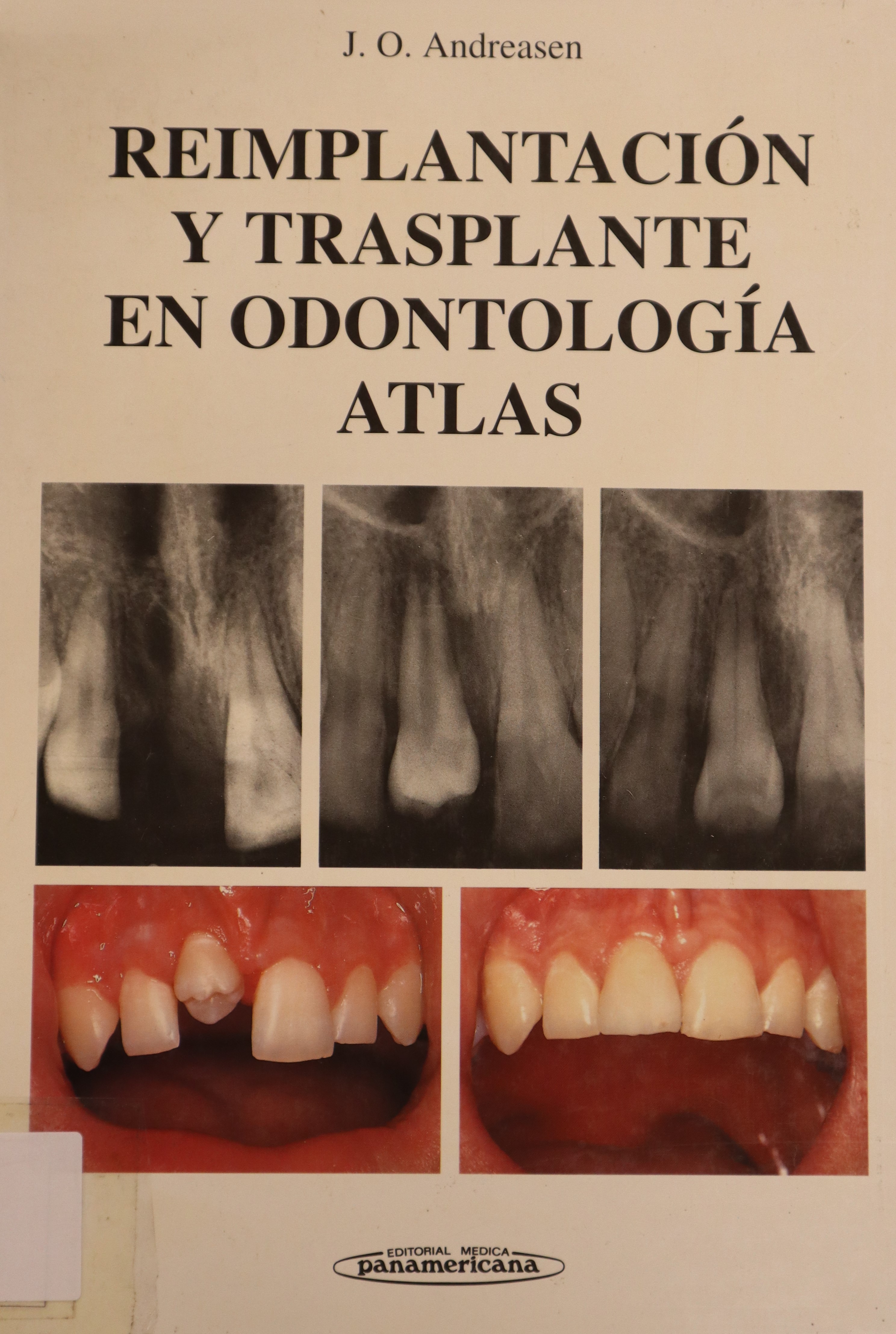 REIMPLANTACIÓN Y TRASPLANTE EN ODONTOLOGÍA ATLAS