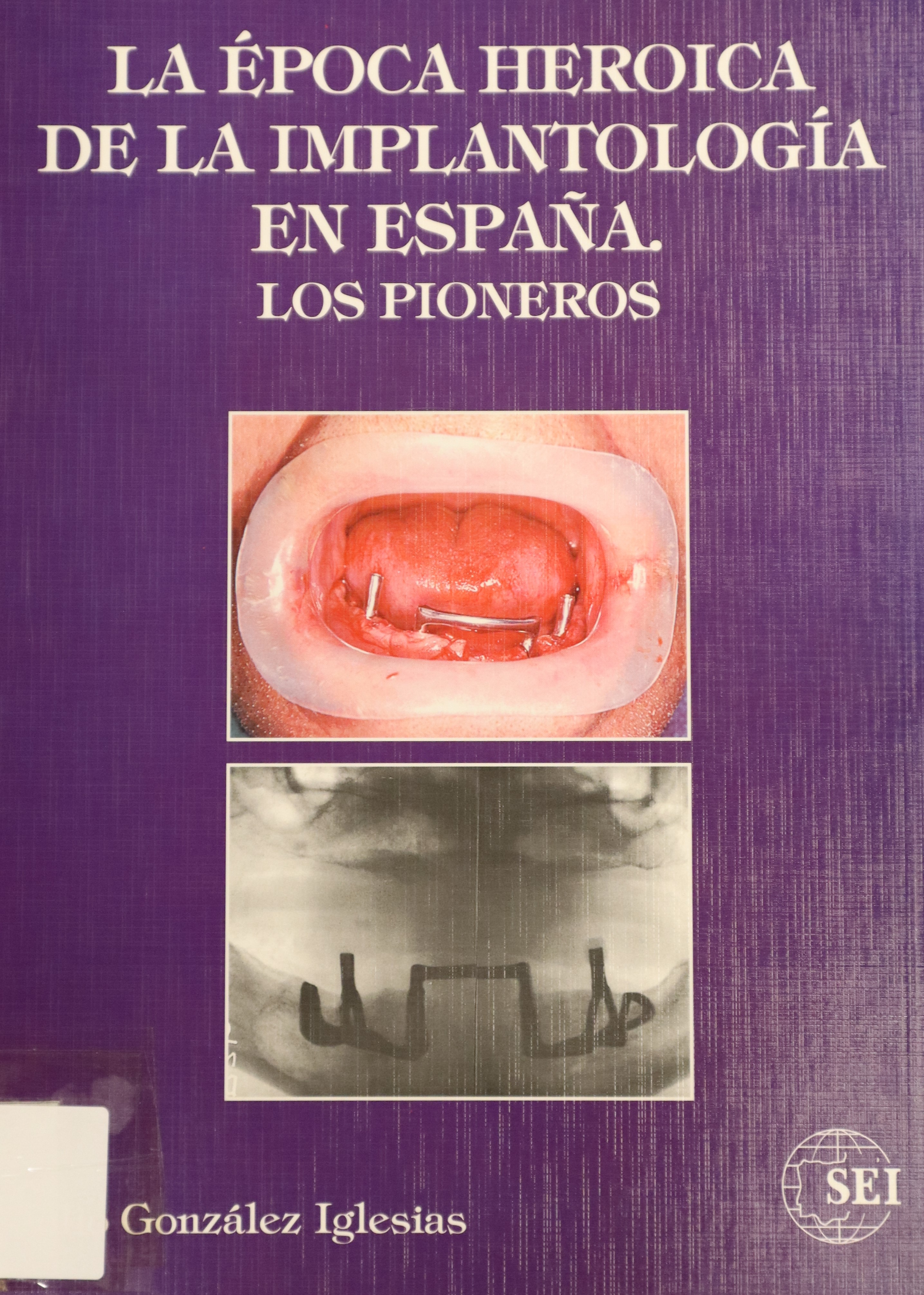 LA ÉPOCA HEROICA DE LA IMPLANTOLOGÍA EN ESPAÑA. LOS PIONEROS.