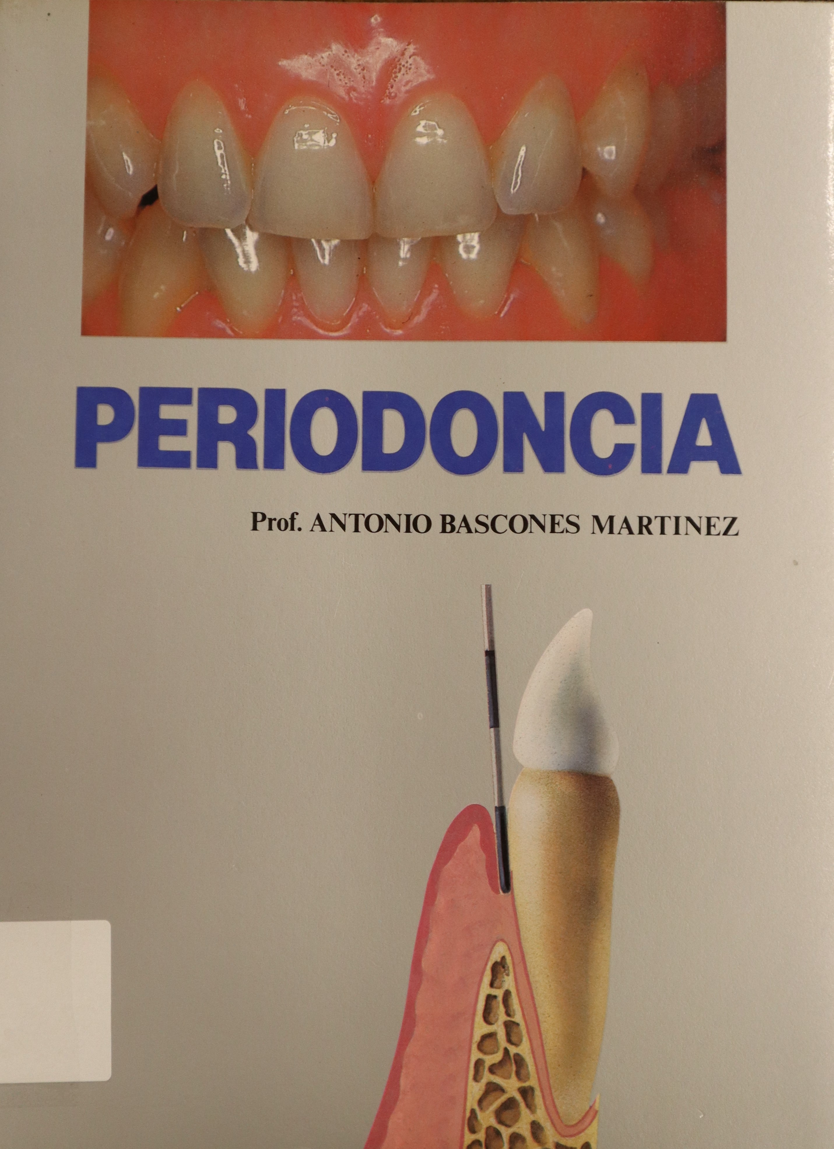 PERIODONCIA