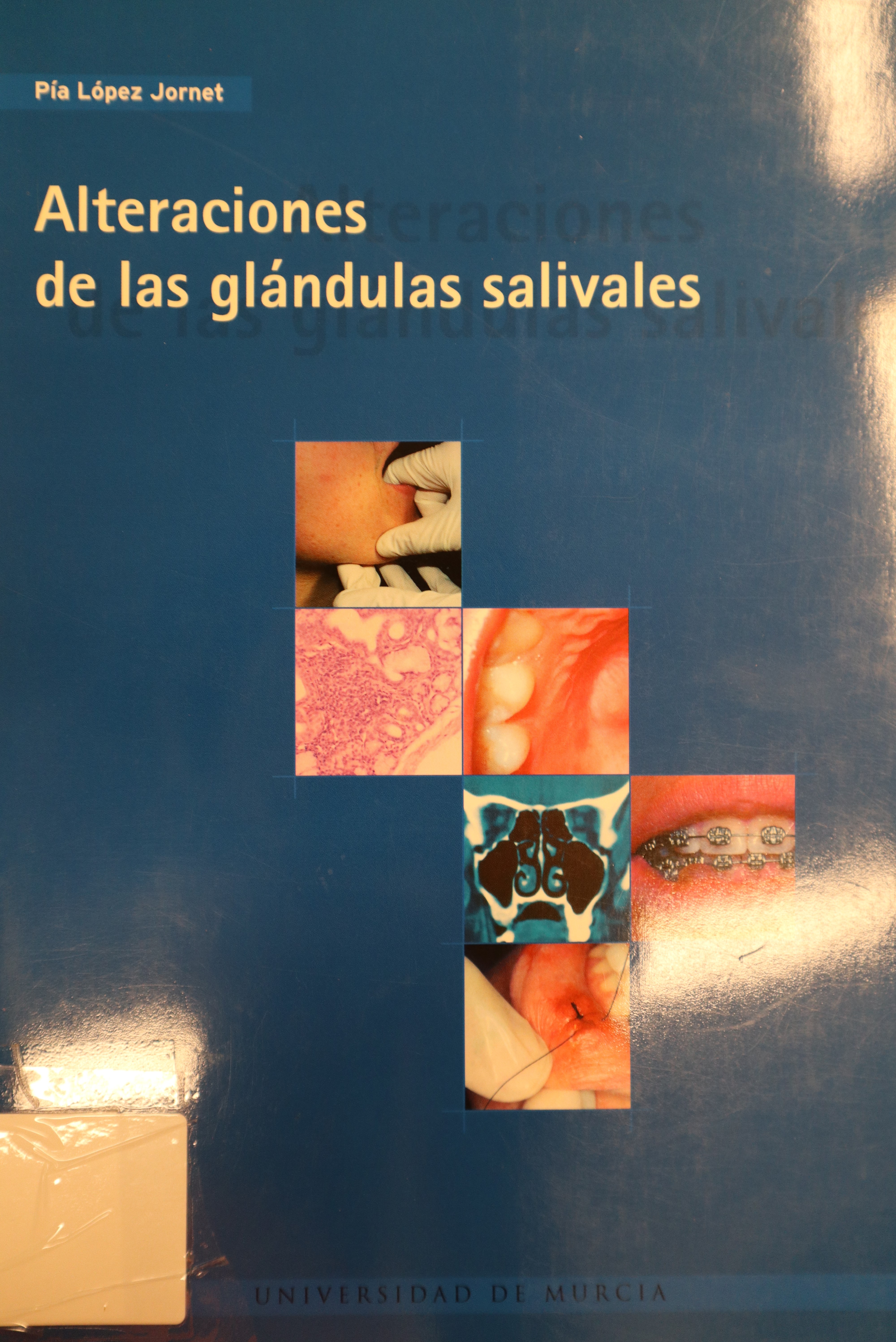 ALTERACIONES DE LAS GLÁNDULAS SALIVALES