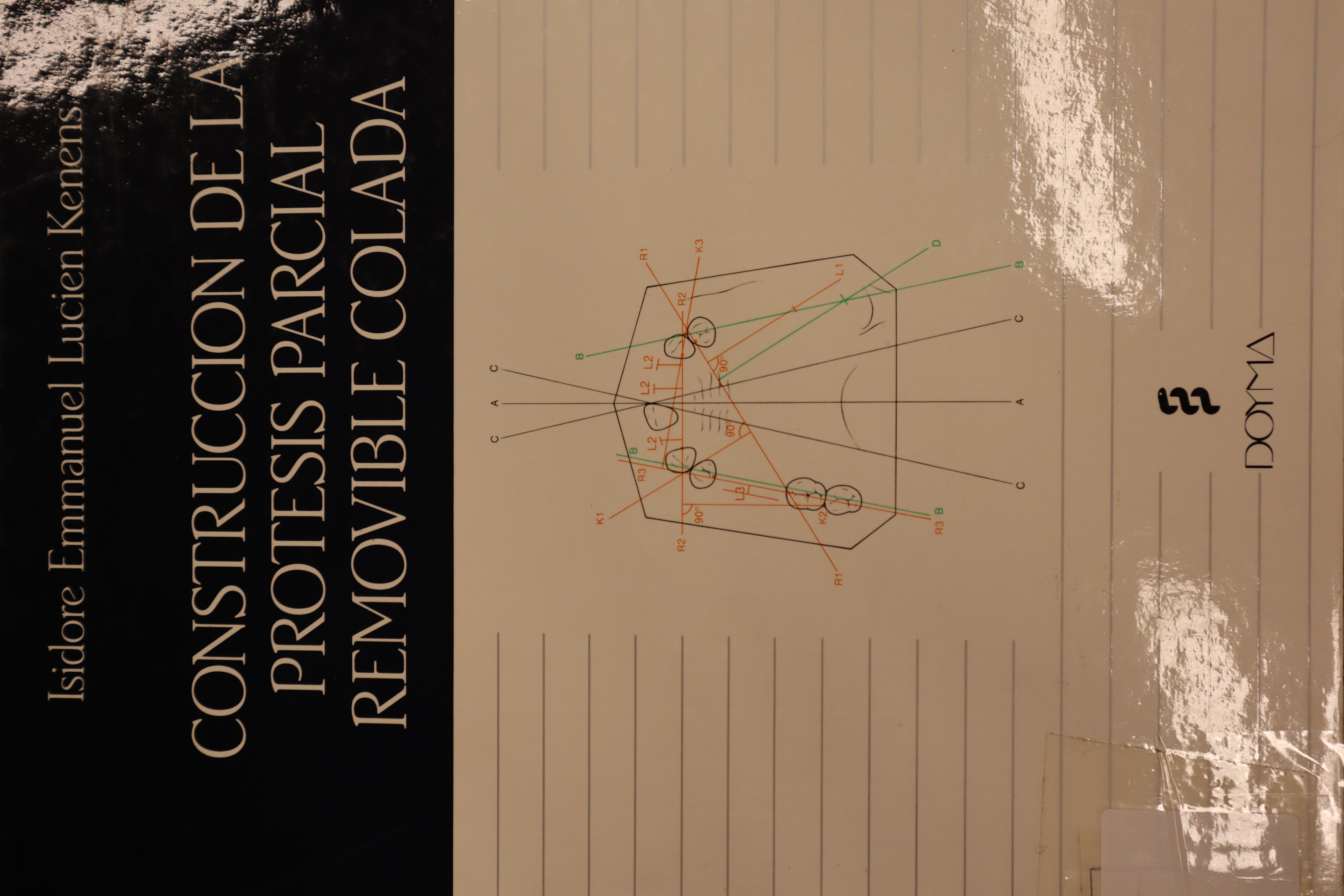 CONSTRUCCIÓN DE LA PRÓTESIS PARCIAL REMOVIBLE COLADA