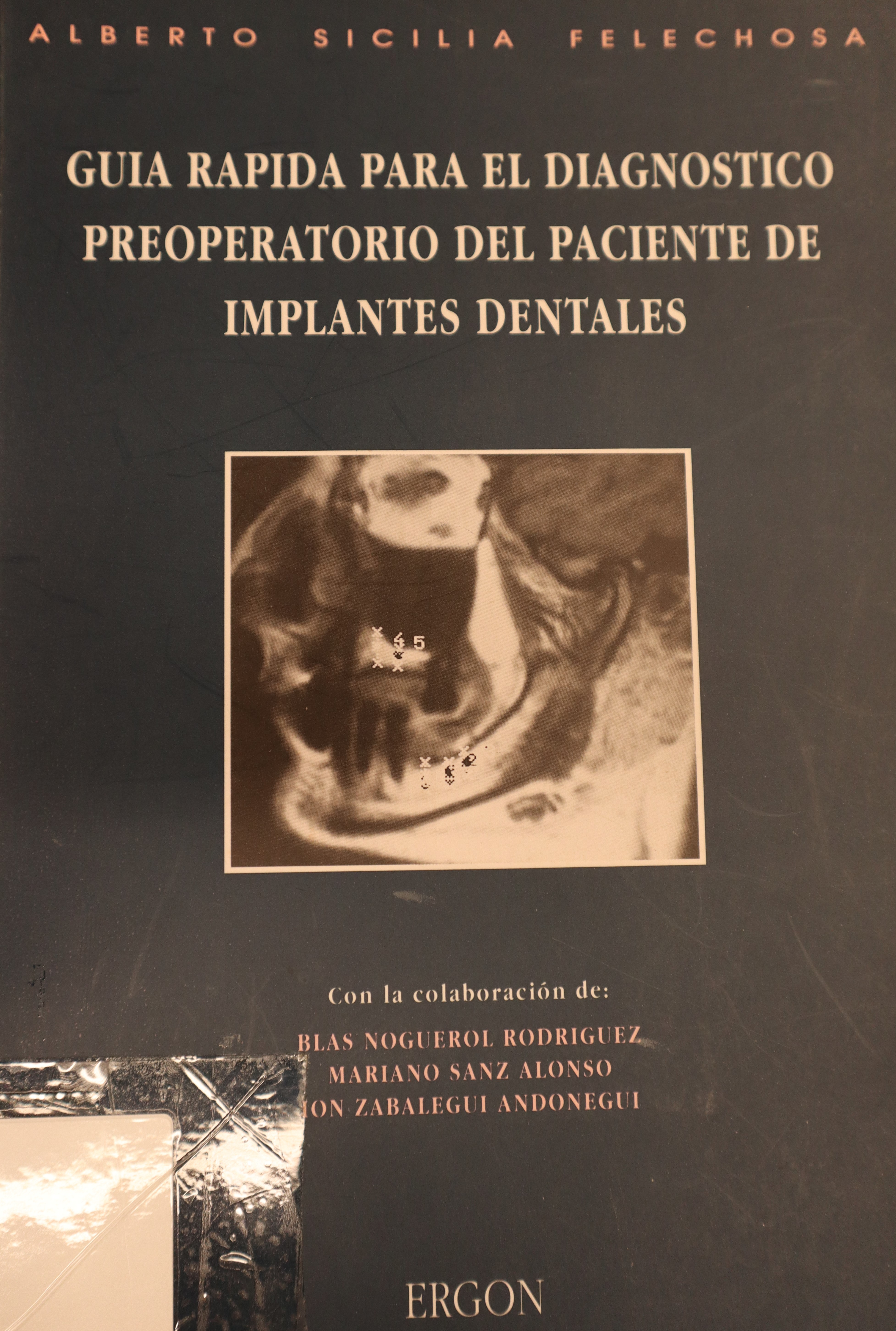 GUÍA RÁPIDA PARA EL DIAGNÓSTICO PREOPERATORIO DEL PACIENTE DE IMPLANTES DENTALES