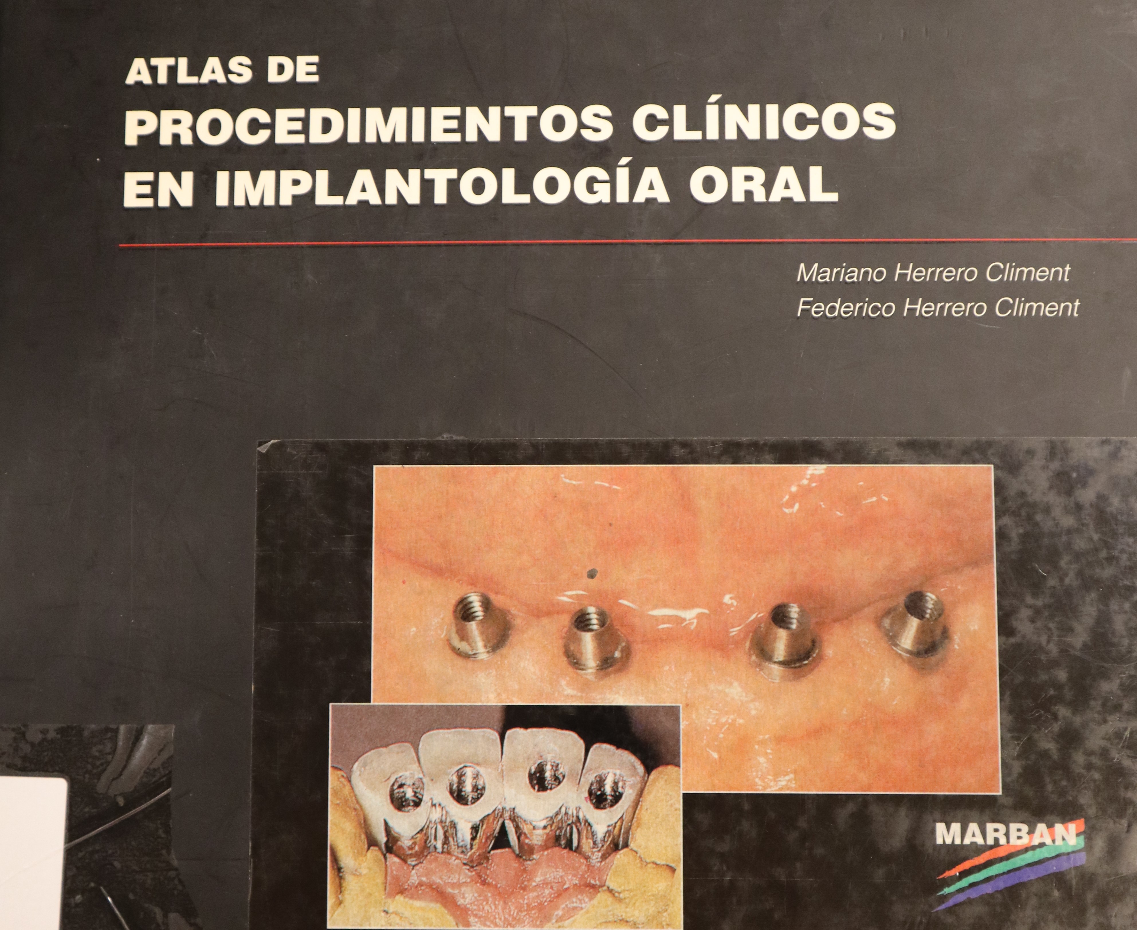 ATLAS DE PROCEDIMIENTOS CLÍNICOS EN IMPLANTOLOGÍA ORAL