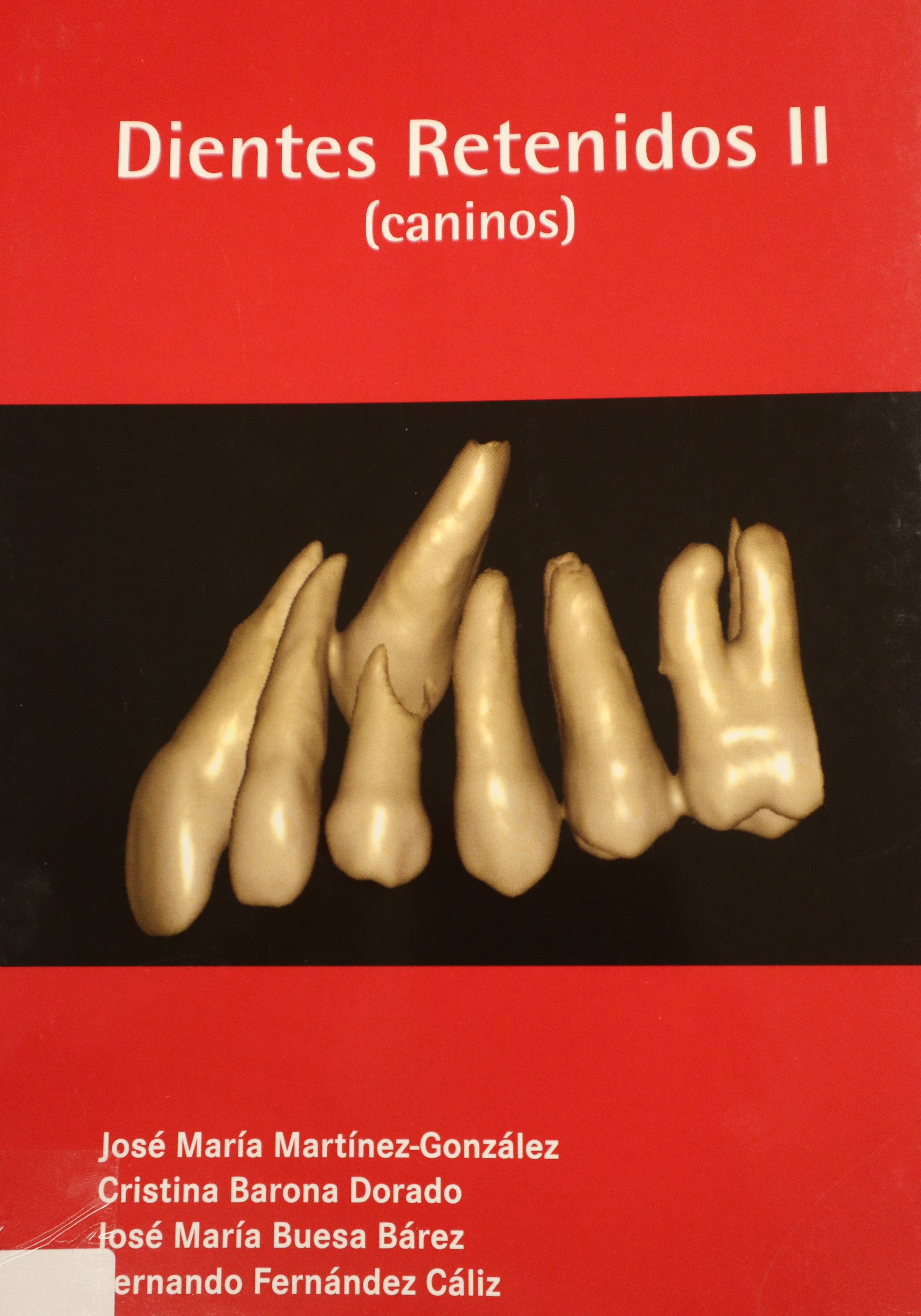 DIENTES RETENIDOS II (CANINOS)