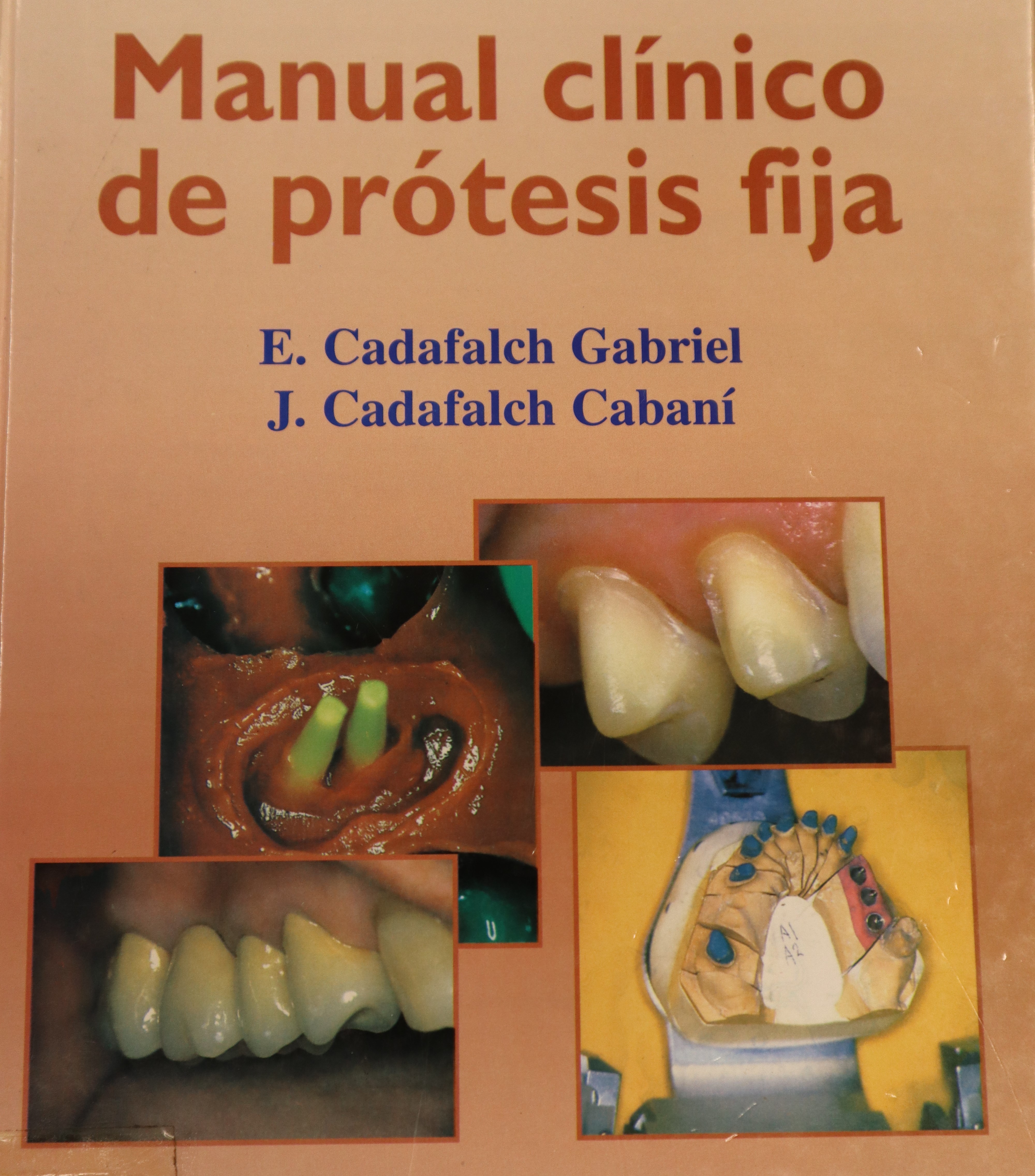 MANUAL CLÍNICO DE PRÓTESIS FIJA