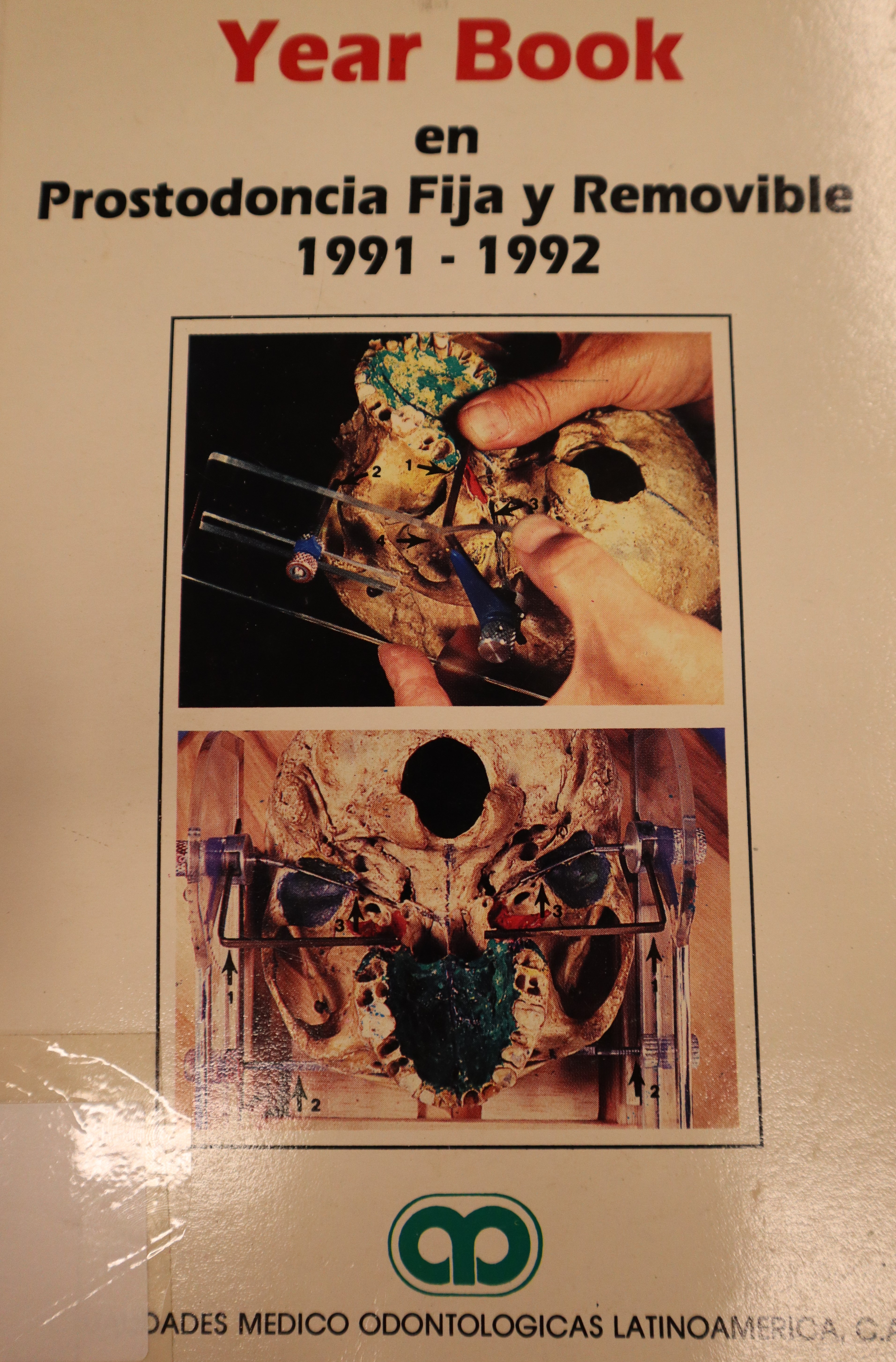 YEAR BOOK EN PROSTODONCIA FIJA Y REMOVIBLE 1991-1992
