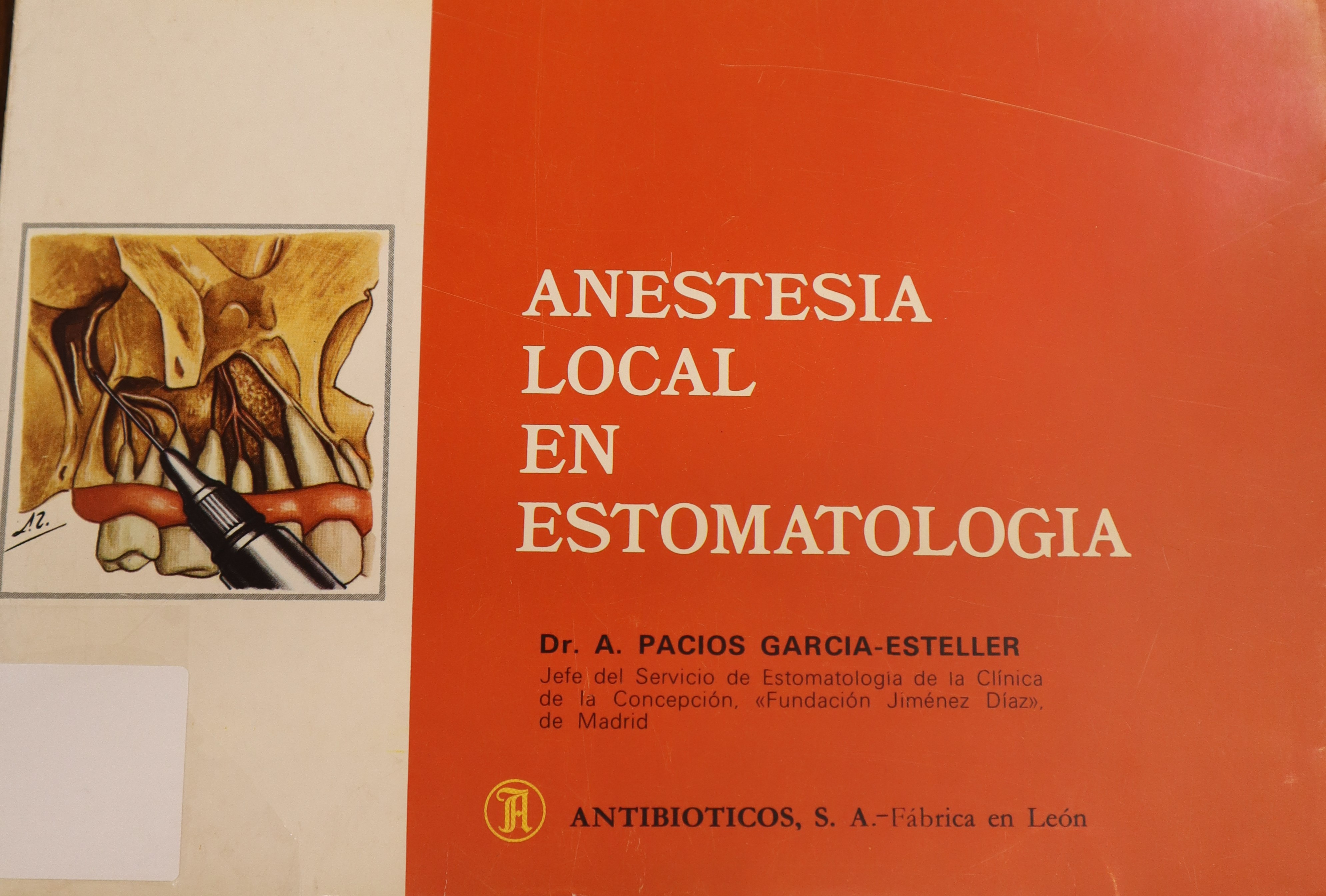 ANESTESIA LOCAL EN ESTOMATOLOGÍA