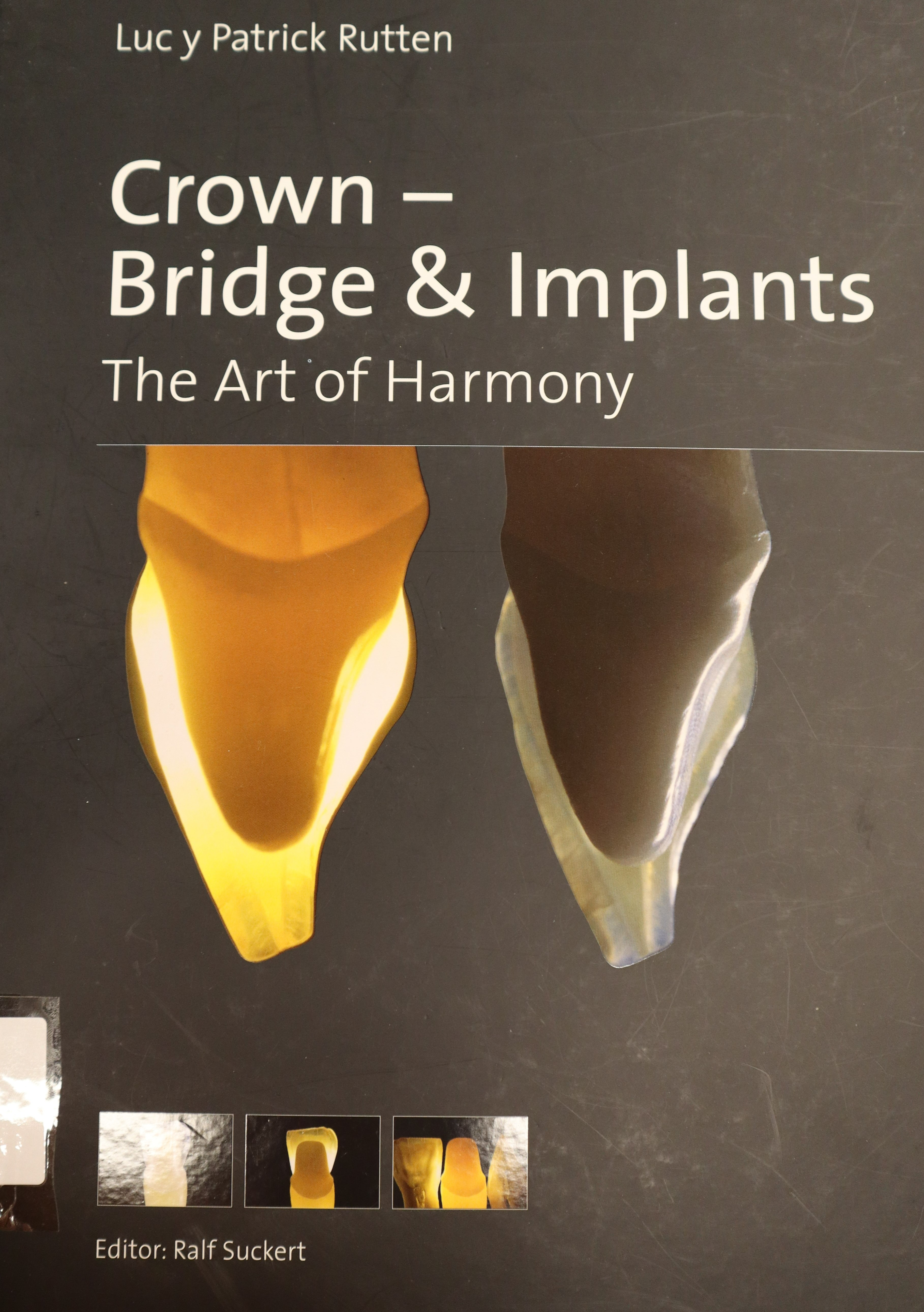 CROWN - BRIDGE & IMPLANTS. THE ART OF HARMONY.