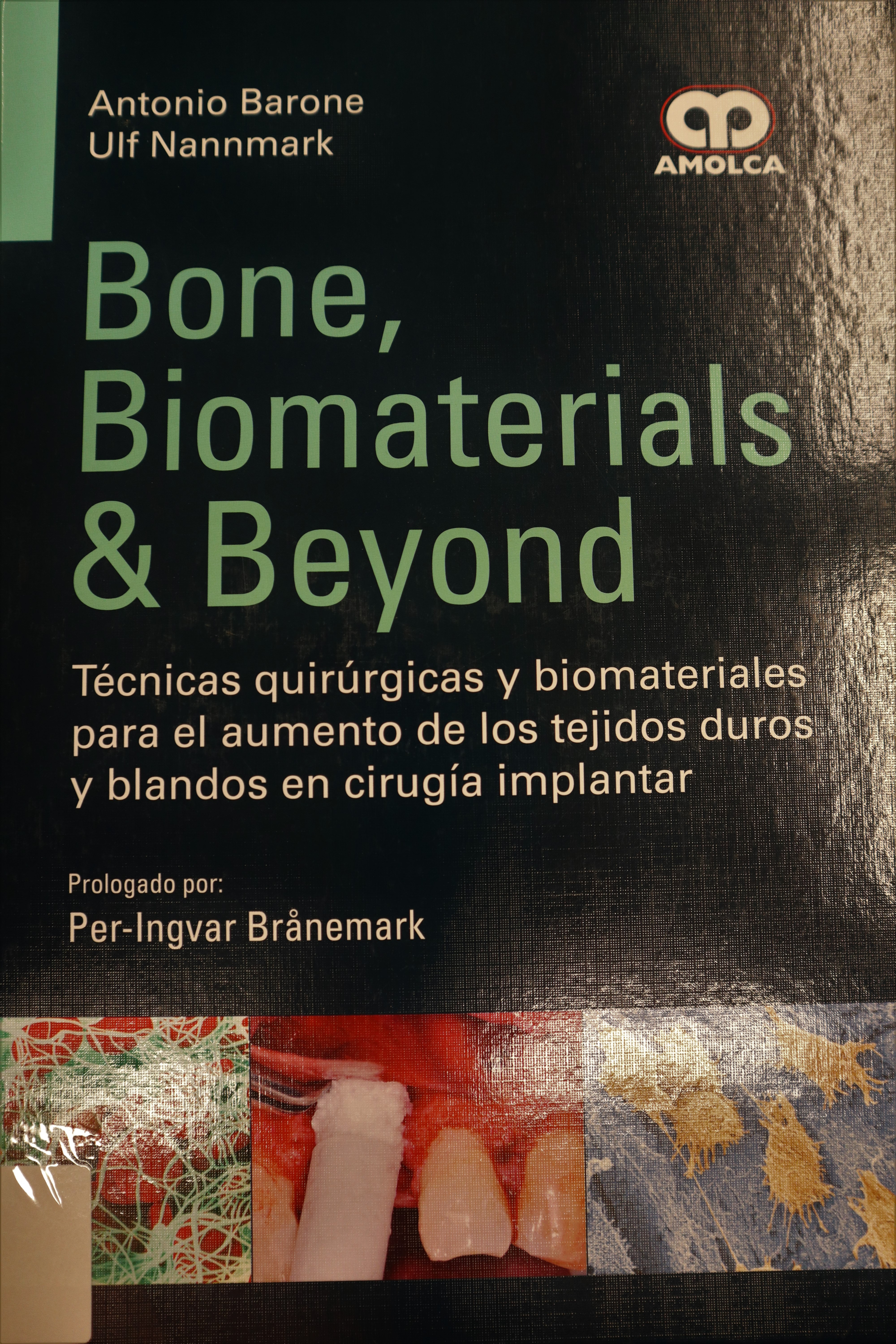 BONE, BIOMATERIALS & BEYOND: TÉCNICAS QUIRÚRGICAS Y BIOMATERIALES PARA EL AUMENTO DE LOS TEJIDOS DUROS Y BLANDOS EN CIRUGÍA IMPLANTAR