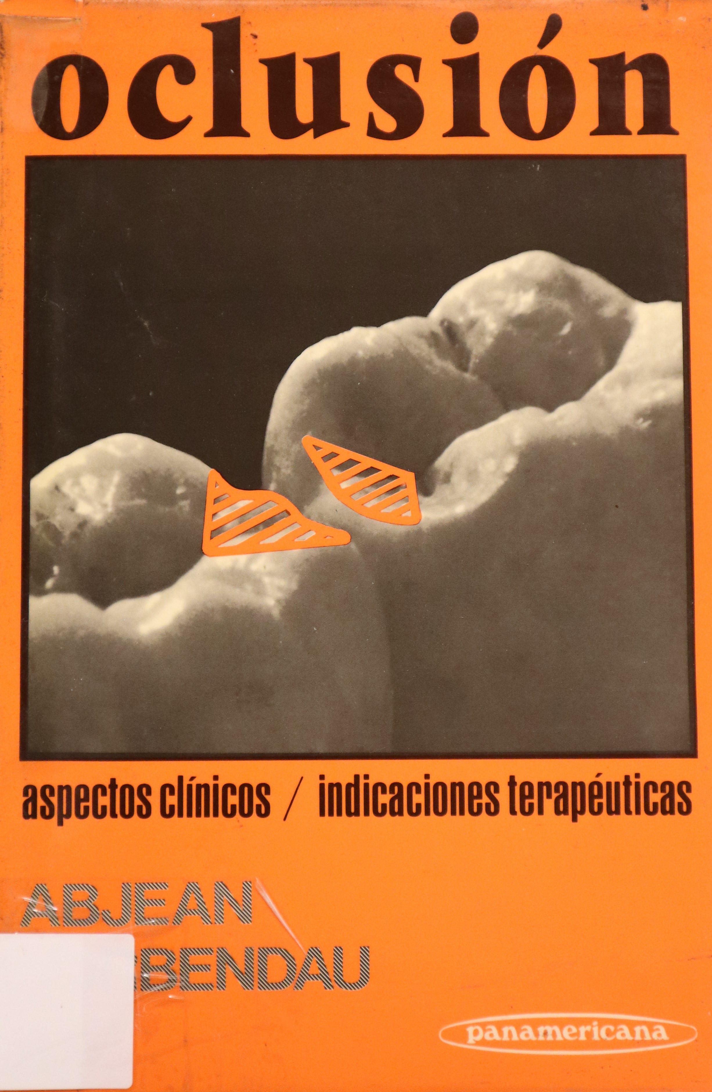 OCLUSIÓN ASPECTOS CLÍNICOS E INDICACIONES TERAPÉUTICAS