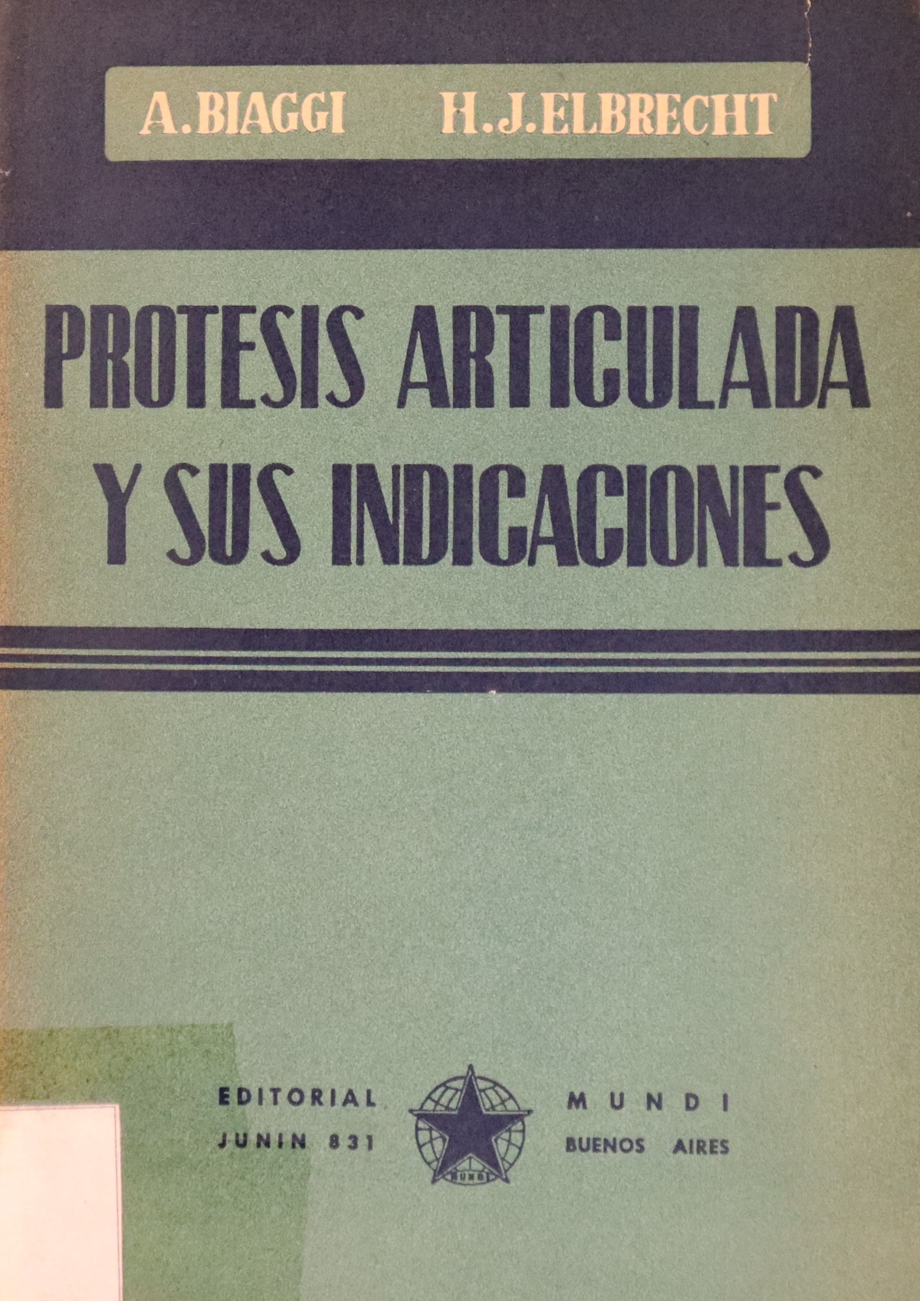 PRÓTESIS ARTICULADA Y SUS INDICACIONES
