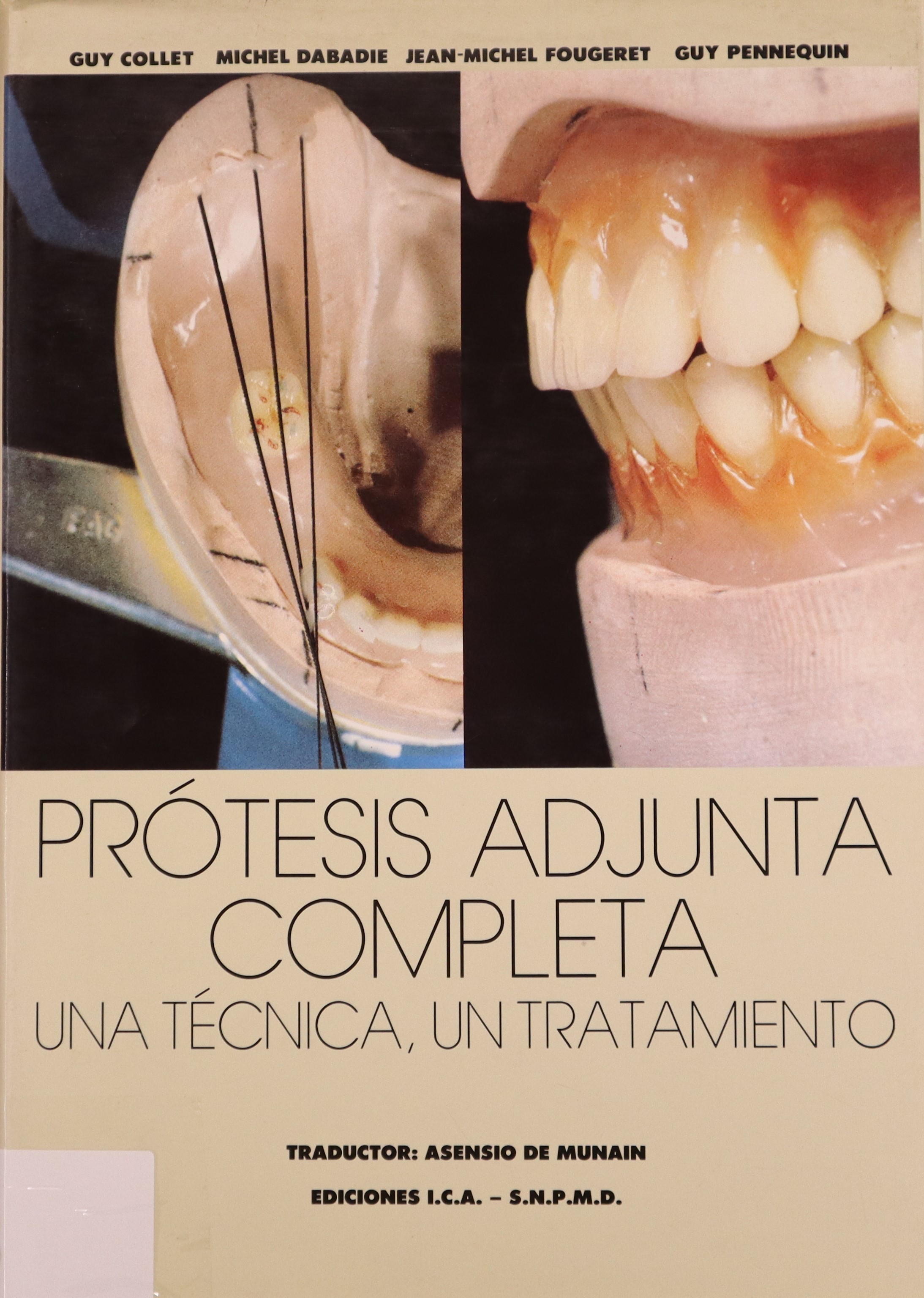 PRÓTESIS ADJUNTA COMPLETA: UNA TÉCNICA, UN TRATAMIENTO