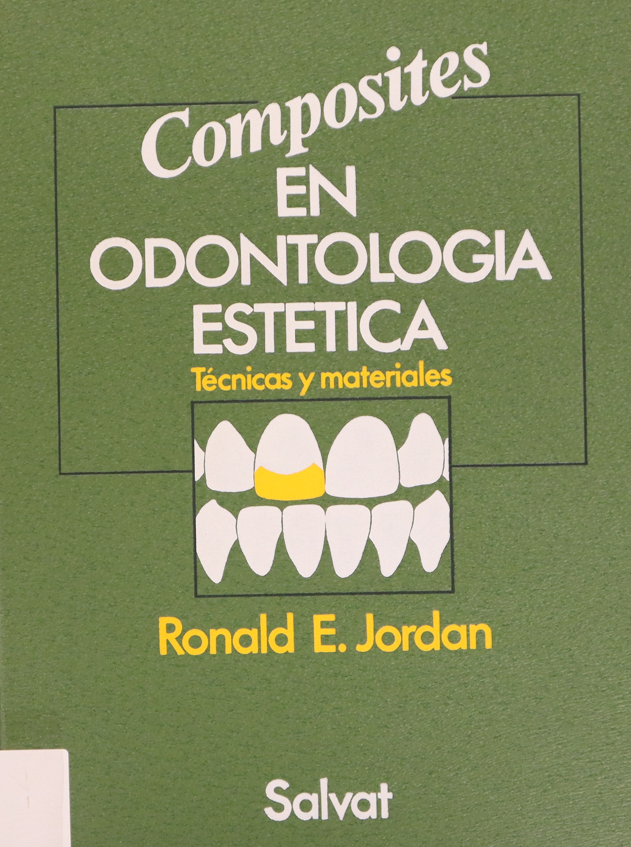 COMPOSITES EN ODONTOLOGÍA ESTÉTICA: TÉCNICAS Y MATERIALES