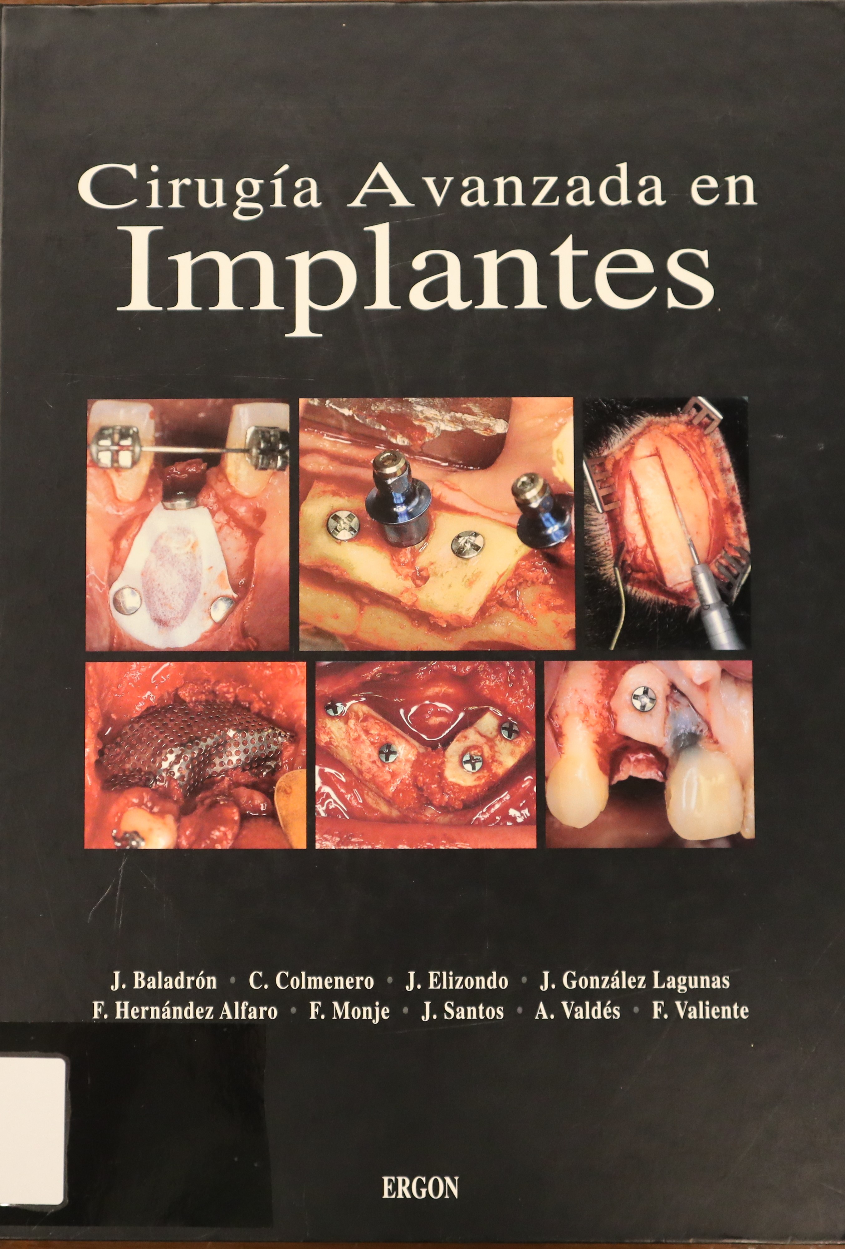 CIRUGÍA AVANZADA EN IMPLANTES