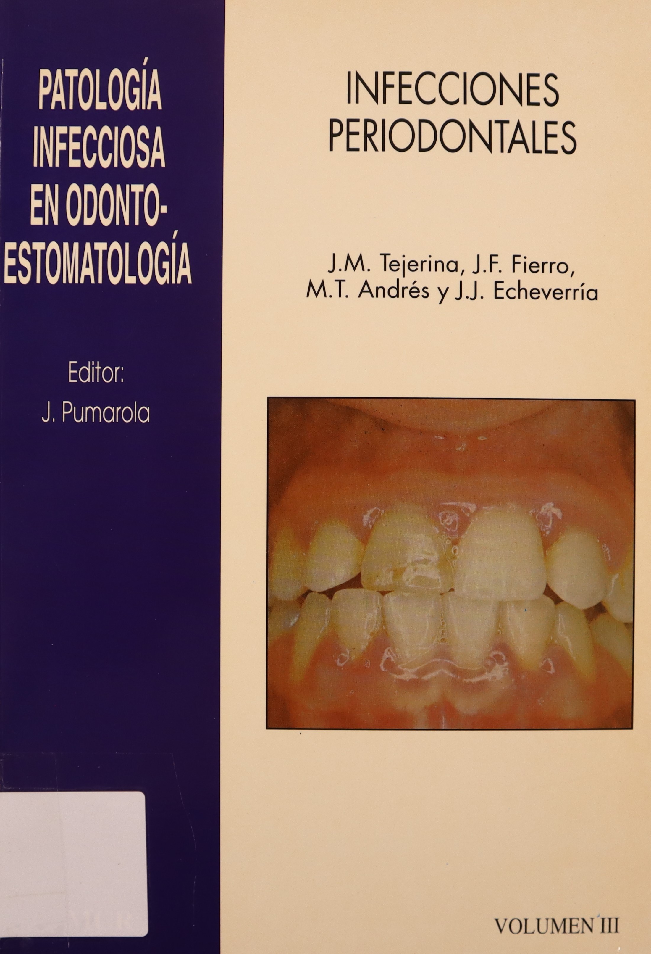 PATOLOGÍA INFECCIOSA EN ODONTO-ESTOMATOLOGÍA. INFECCIONES PERIODONTALES. VOL. III.