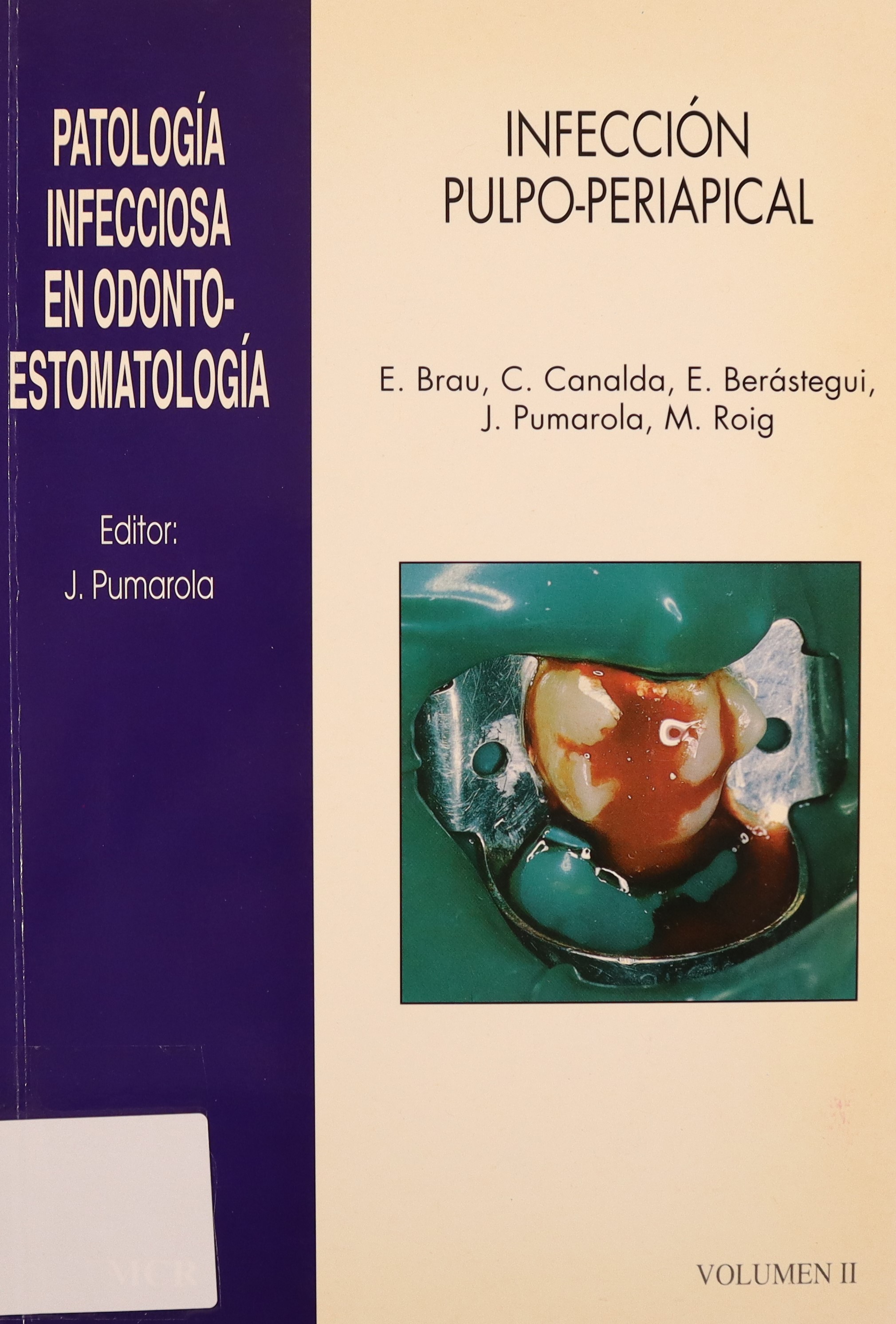 PATOLOGÍA INFECCIOSA EN ODONTO-ESTOMATOLOGÍA. INFECCIÓN PULPO-PERIAPICAL. VOL. II.