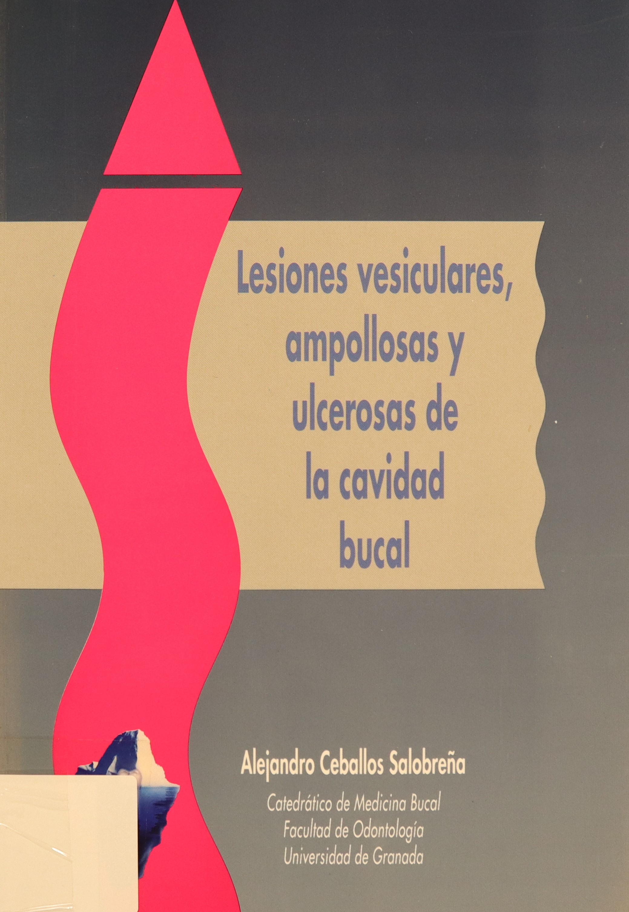 LESIONES VESICULARES, AMPOLLOSAS Y ULCEROSAS DE LA CAVIDAD BUCAL