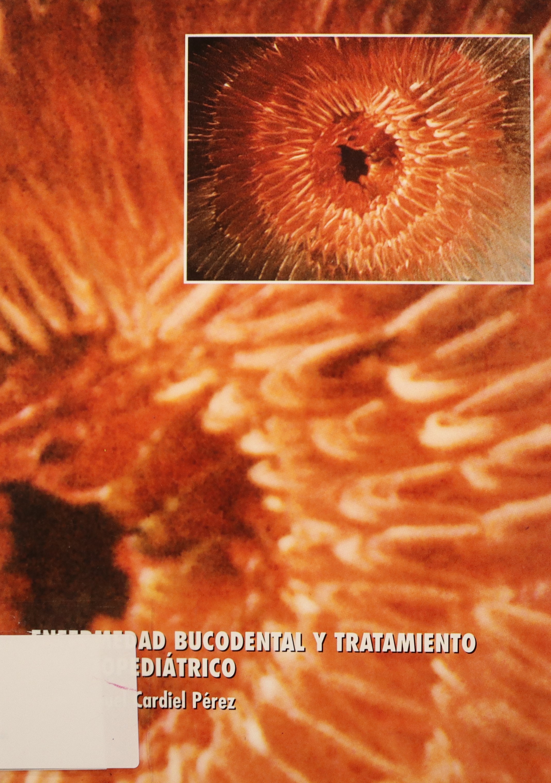 ENFERMEDAD BUCODENTAL Y TRATAMIENTO ODONTOPEDIÁTRICO