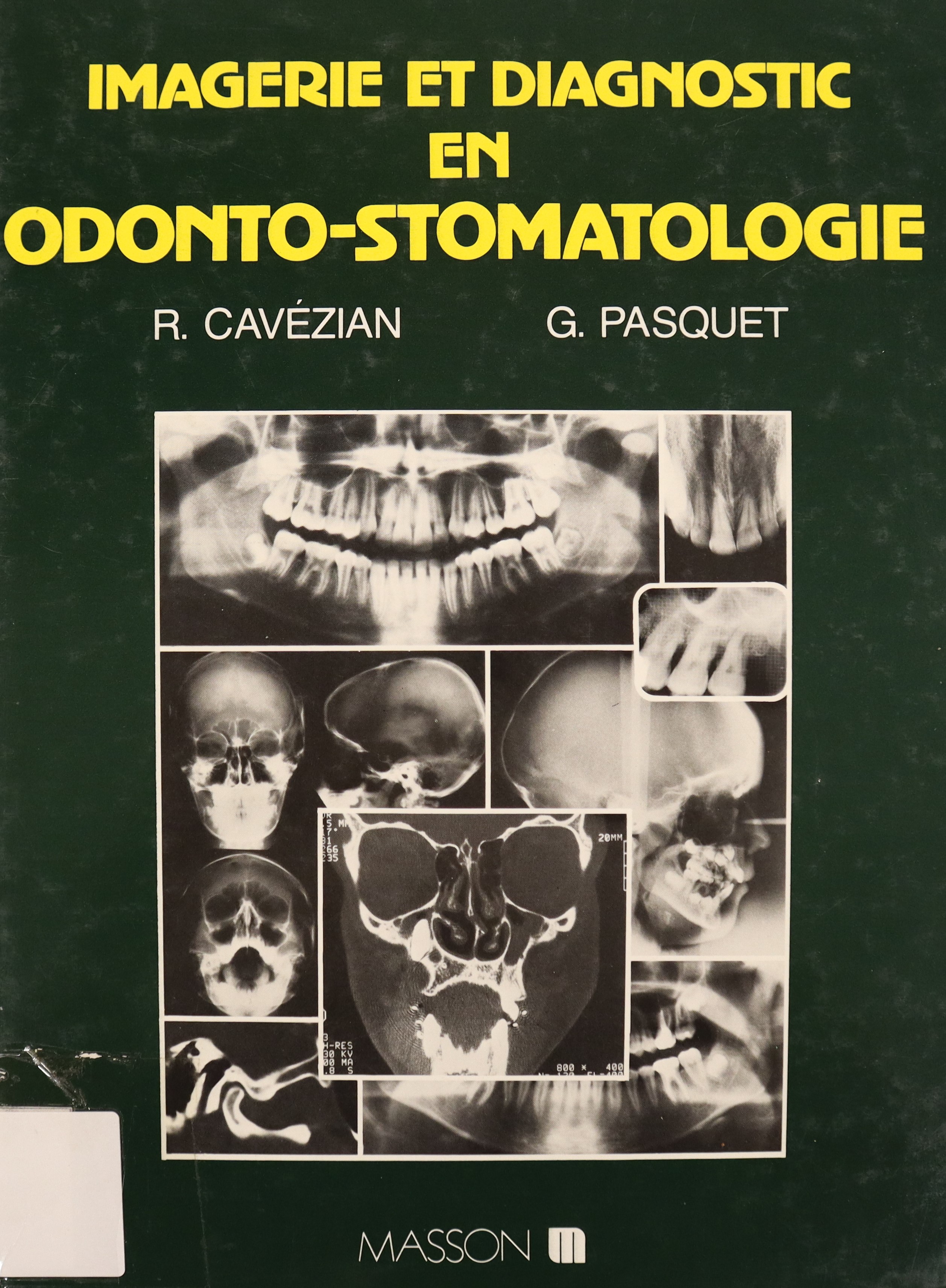IMAGERIE ET DIAGNOSTIC EN ODONTO-STOMATOLOGIE. MOYENS TECHNIQUES. ANATOMIE NORMALE. RÉSULTATS PATHOLOGIQUES.