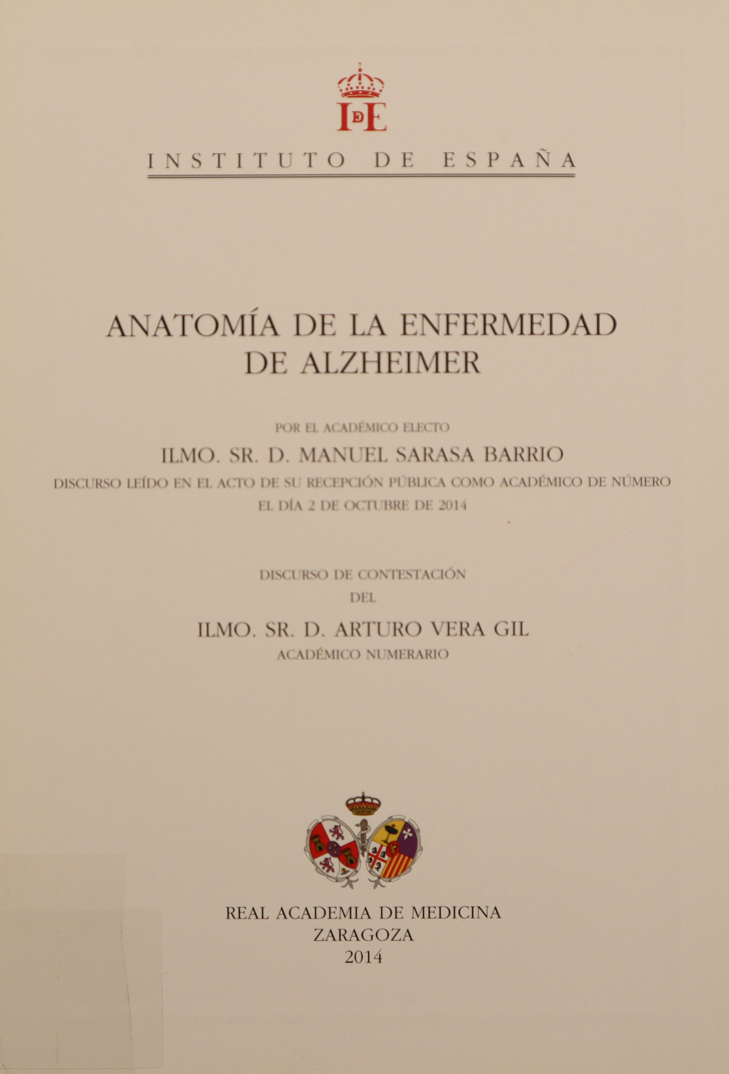 ANATOMÍA DE LA ENFERMEDAD DE ALZHEIMER