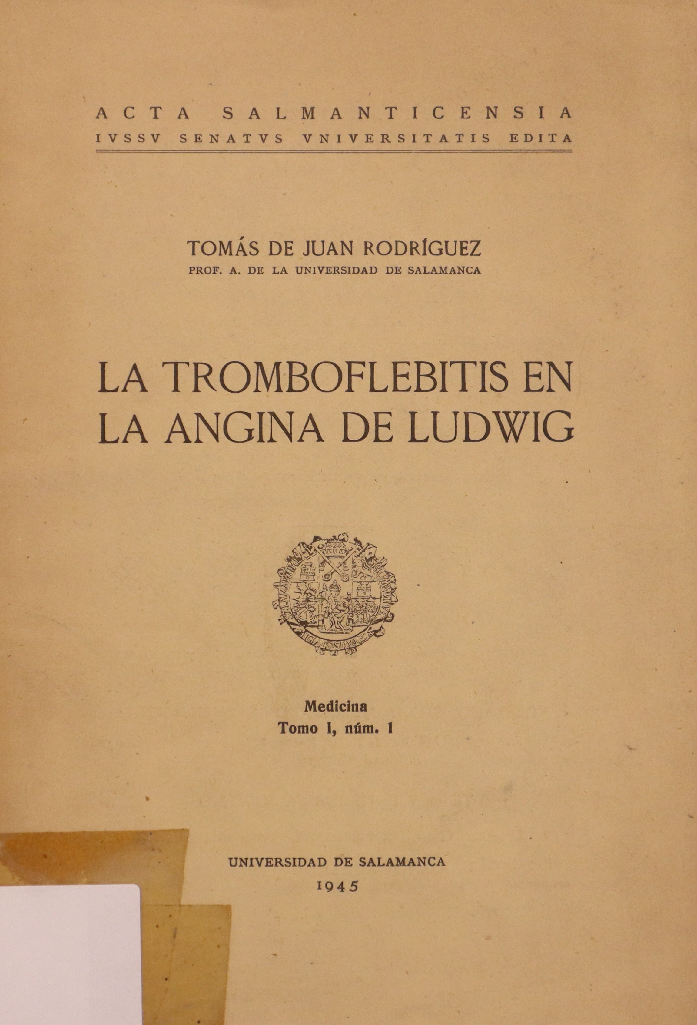 LA TROMBOFLEBITIS EN LA ANGINA DE LUDWIG