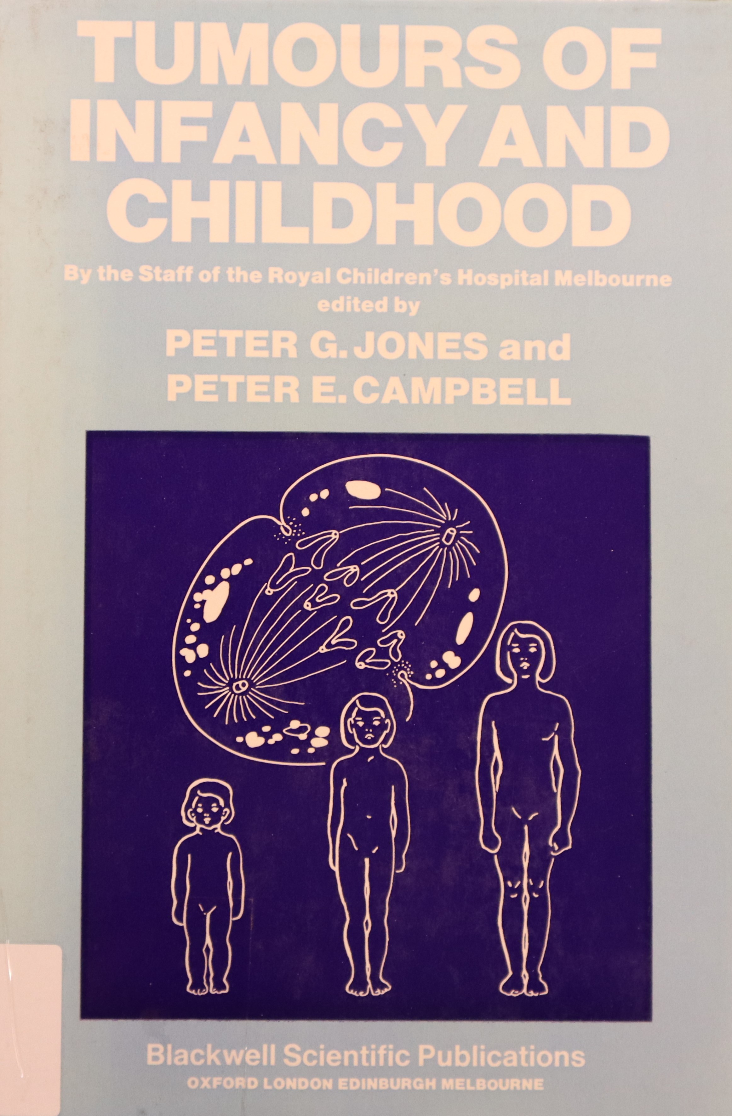 TUMOURS OF INFANCY AND CHILHOOD