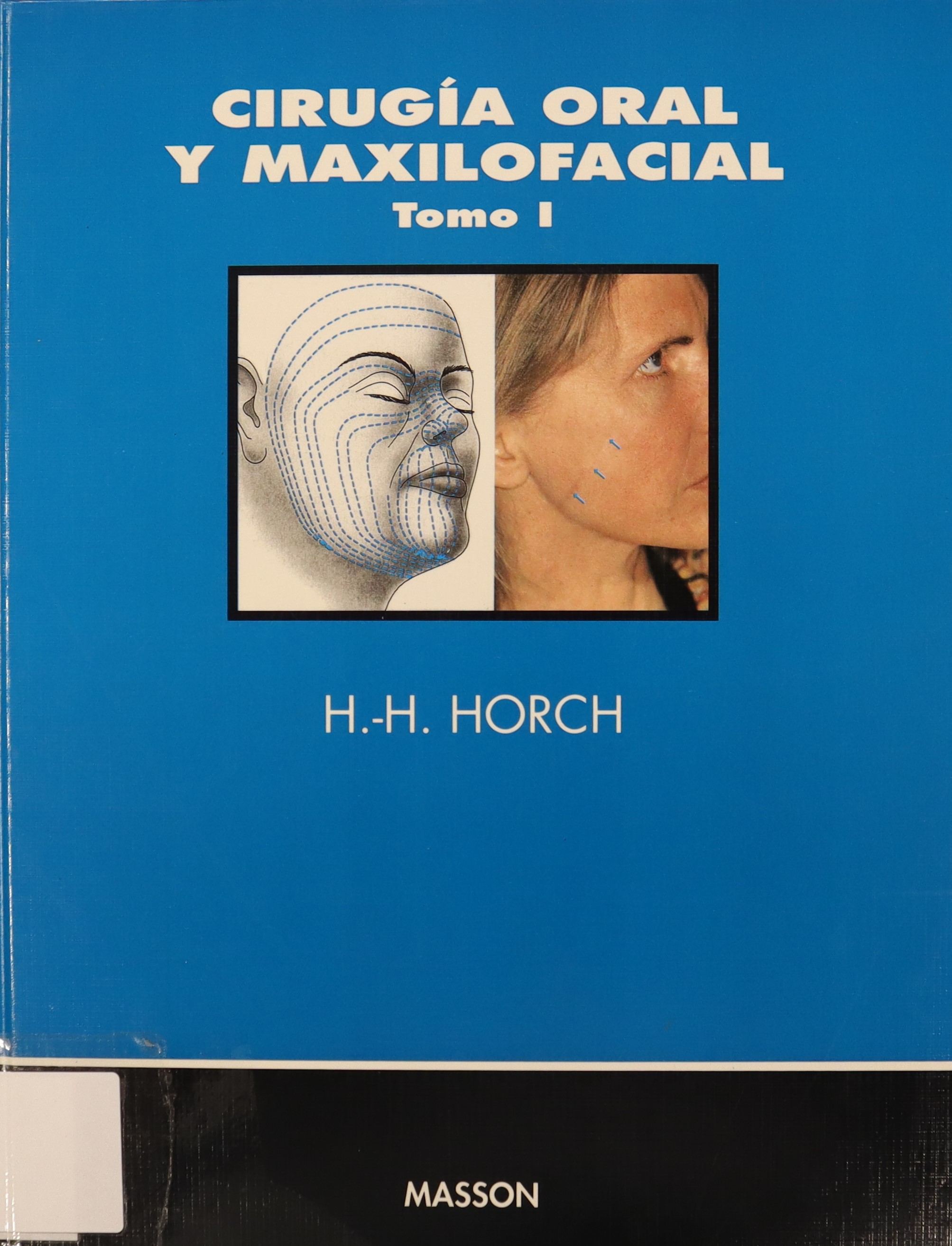 CIRUGÍA ORAL Y MAXILOFACIAL