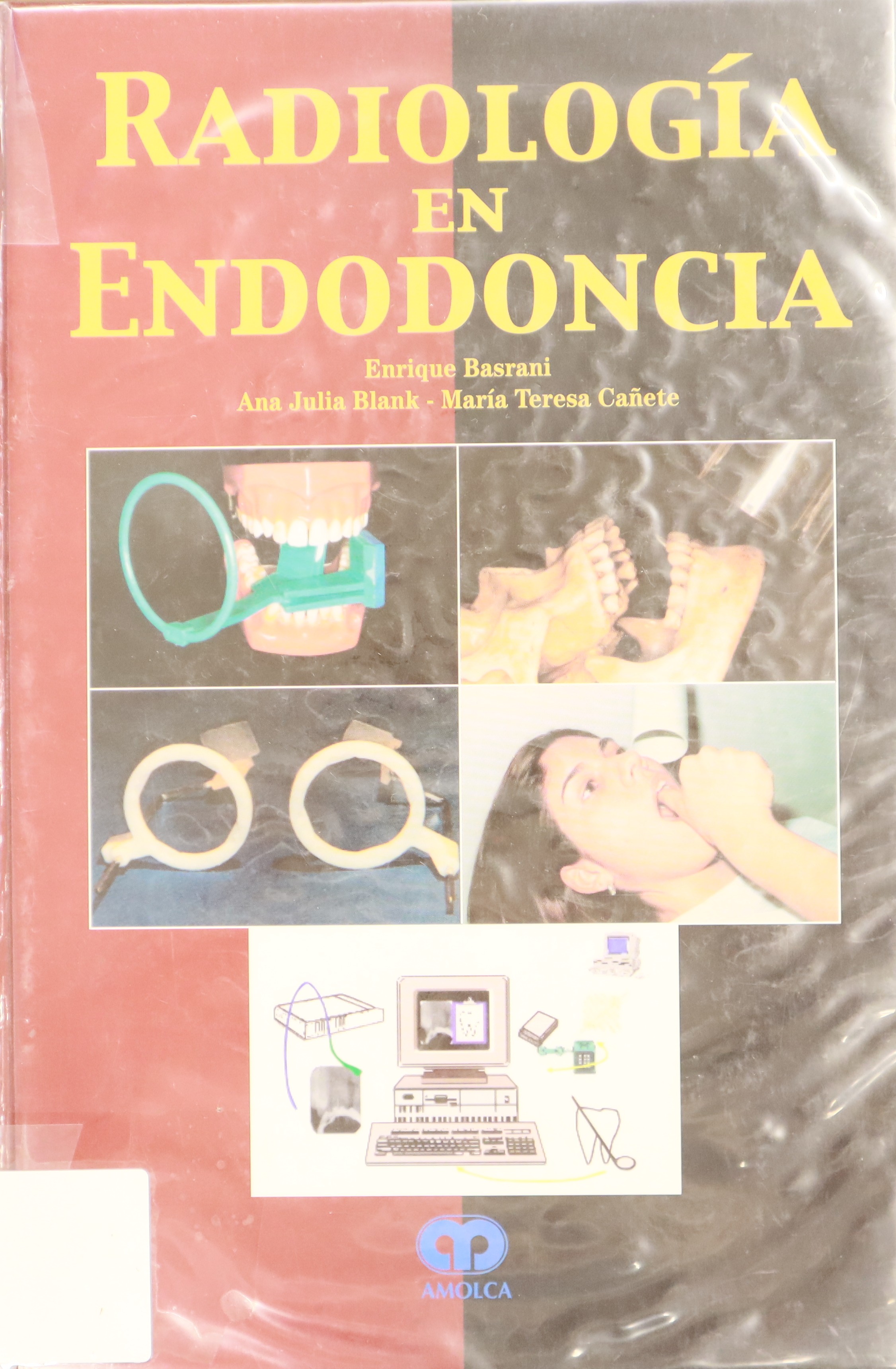 RADIOLOGÍA EN ENDODONCIA